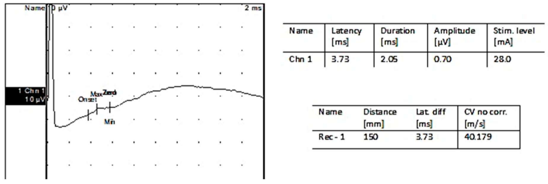 Jpm 13 00076 g005 Jpm 13 00076 g005