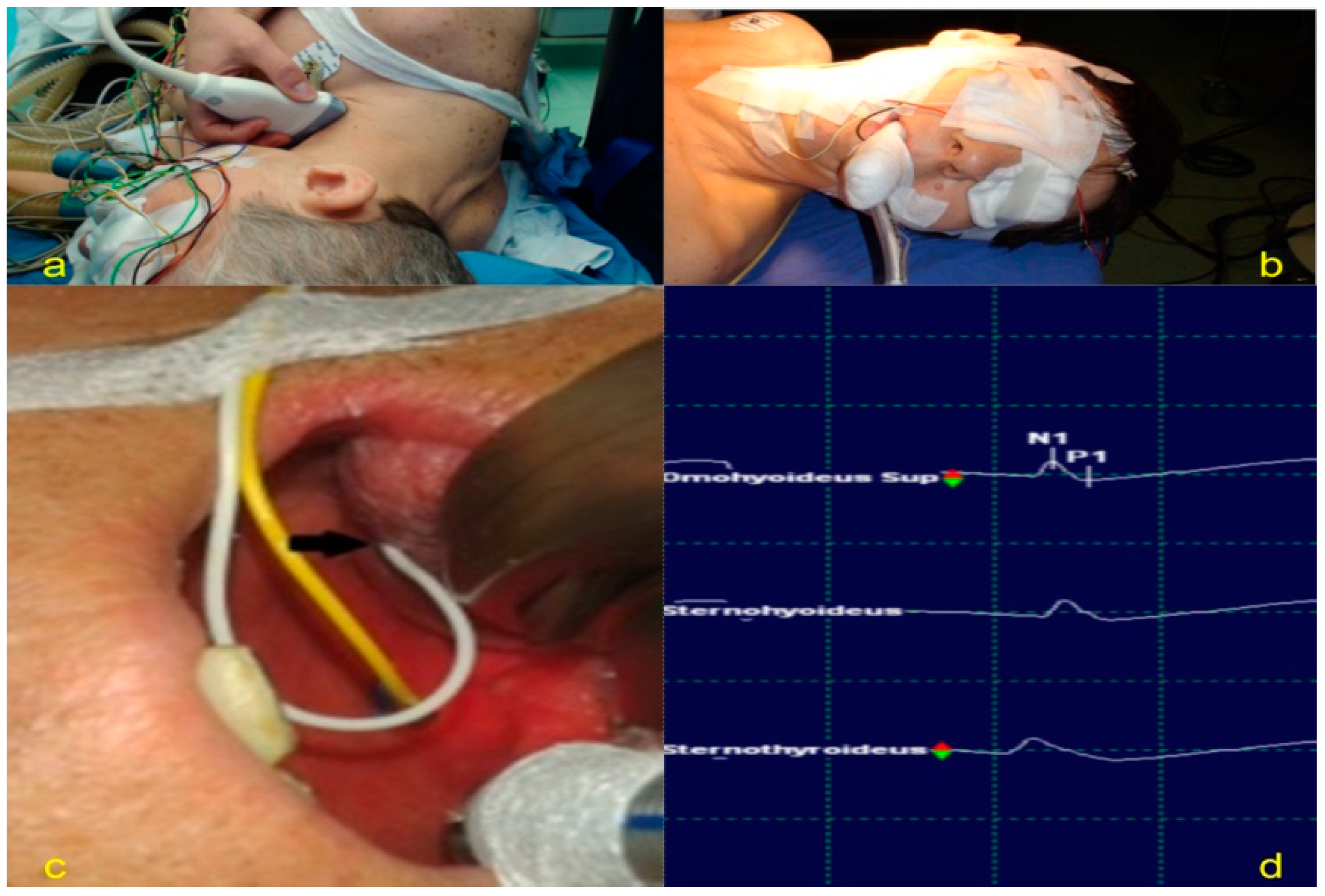 Jpm 13 00076 g006 Jpm 13 00076 g006