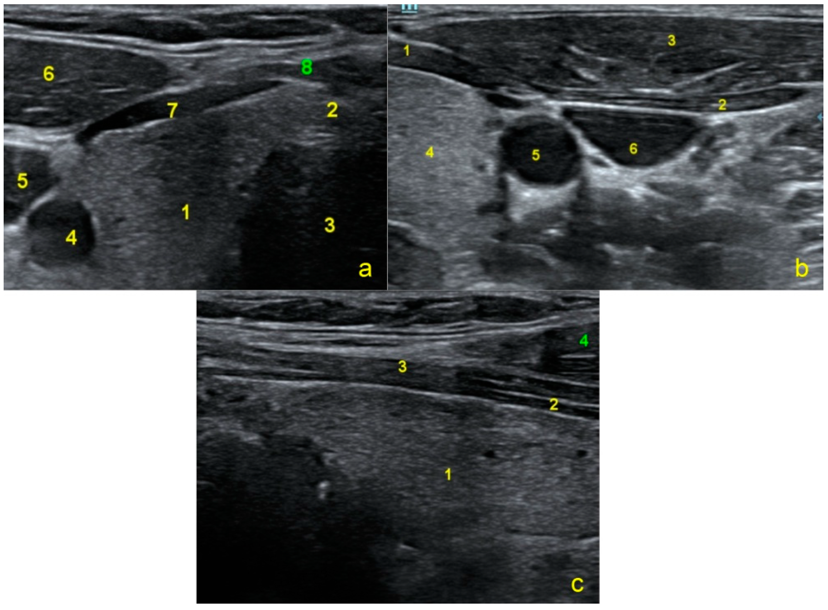 Jpm 13 00076 g007 Jpm 13 00076 g007