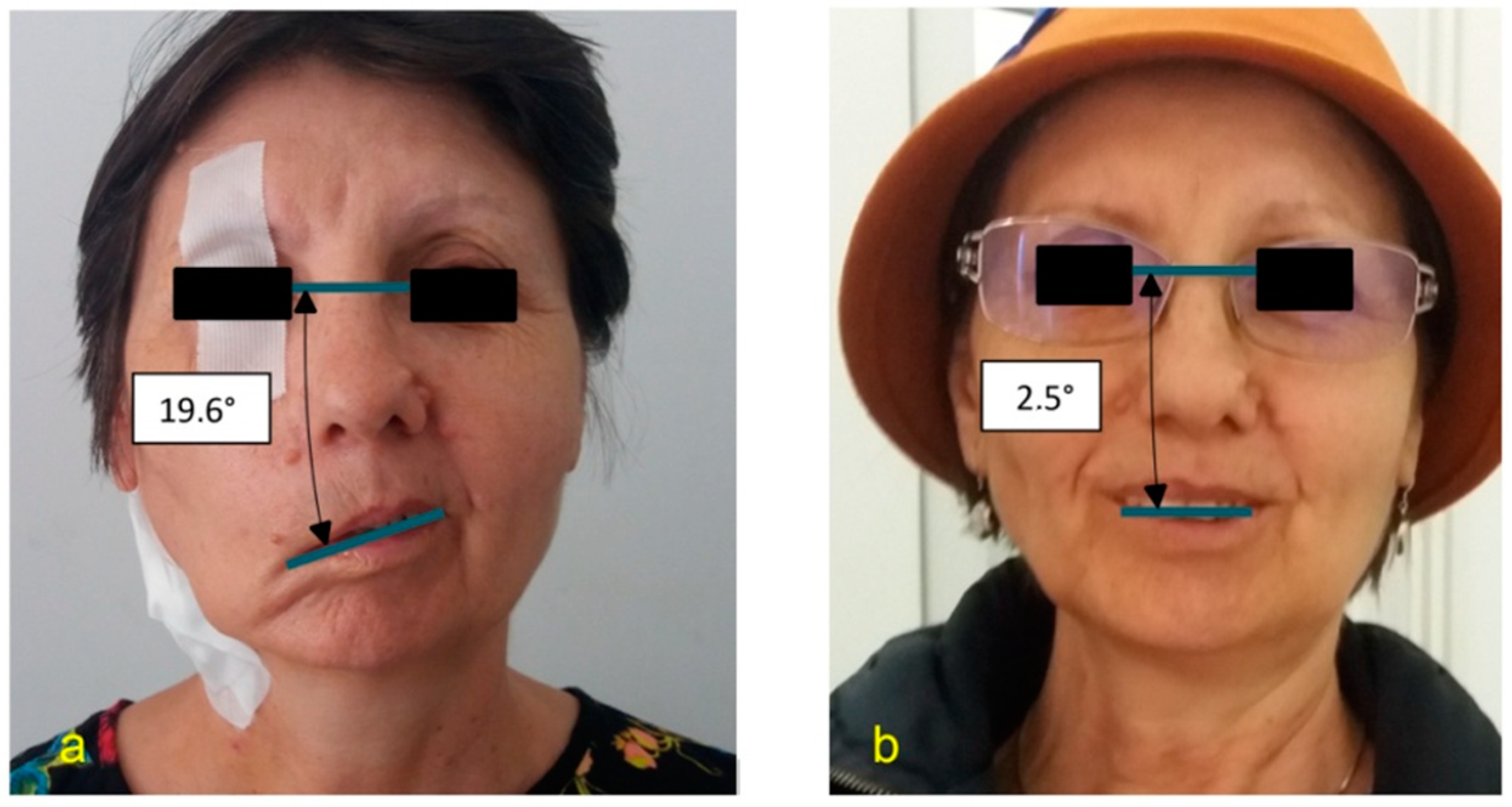 Jpm 13 00076 g009 Jpm 13 00076 g009