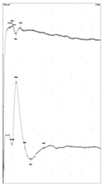 Jpm 13 00076 g011 Jpm 13 00076 g011