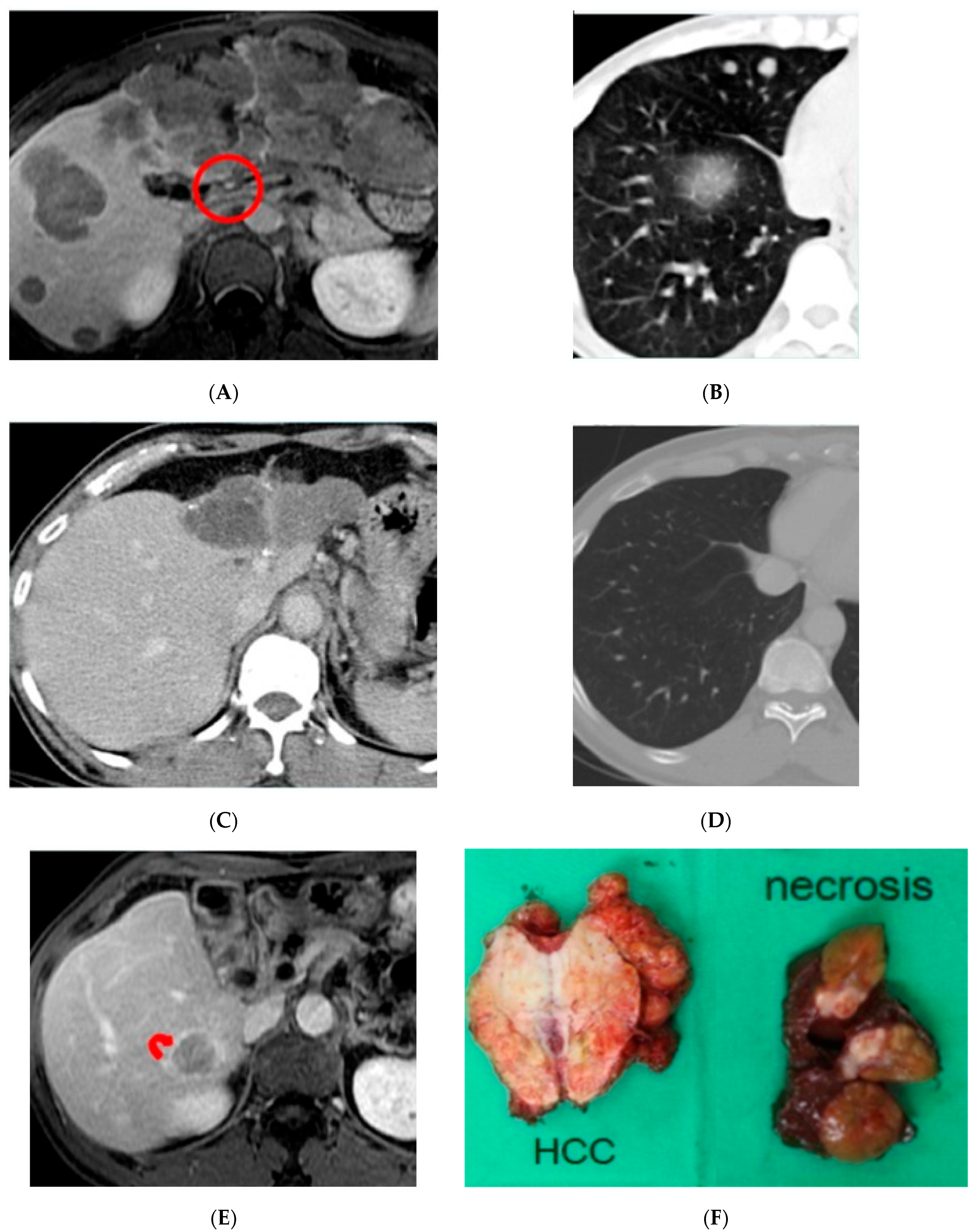 Jpm 13 00088 g002 Jpm 13 00088 g002