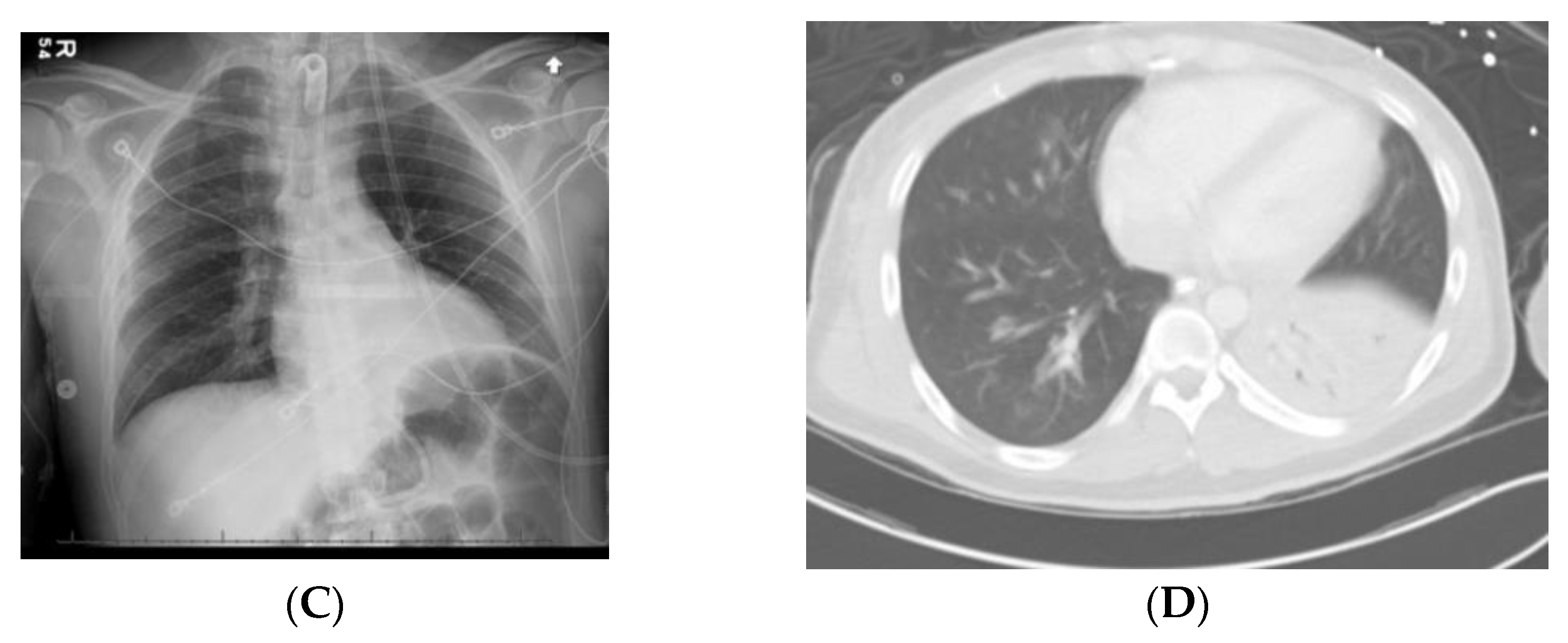 Jpm 13 00097 g001b Jpm 13 00097 g001b