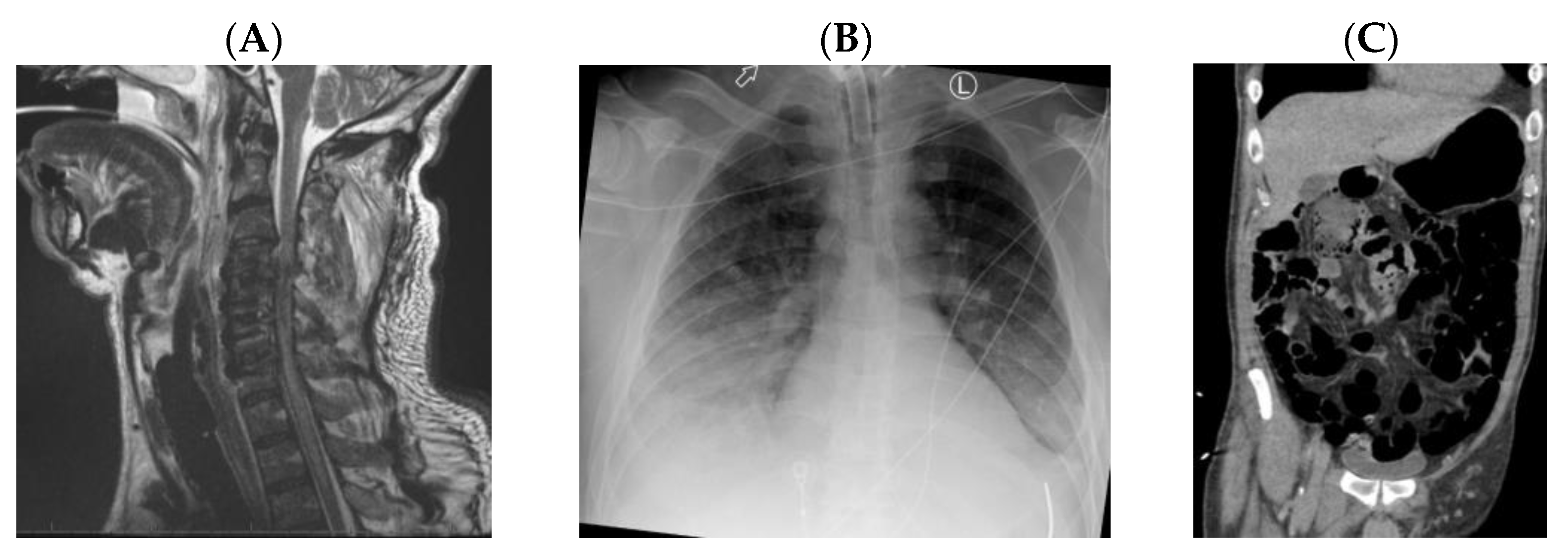 Jpm 13 00097 g002 Jpm 13 00097 g002