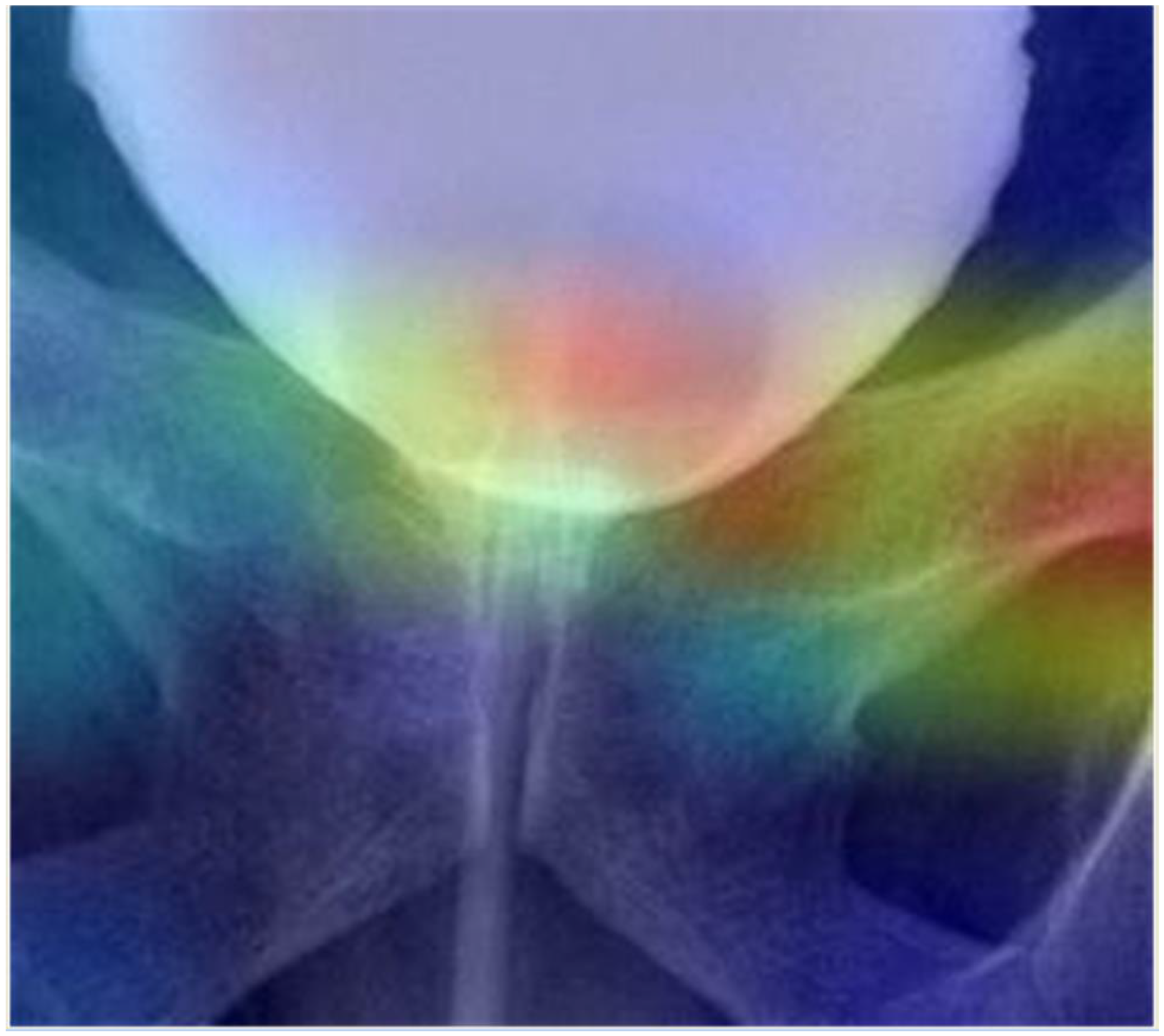 Jpm 13 00126 g004 Jpm 13 00126 g004