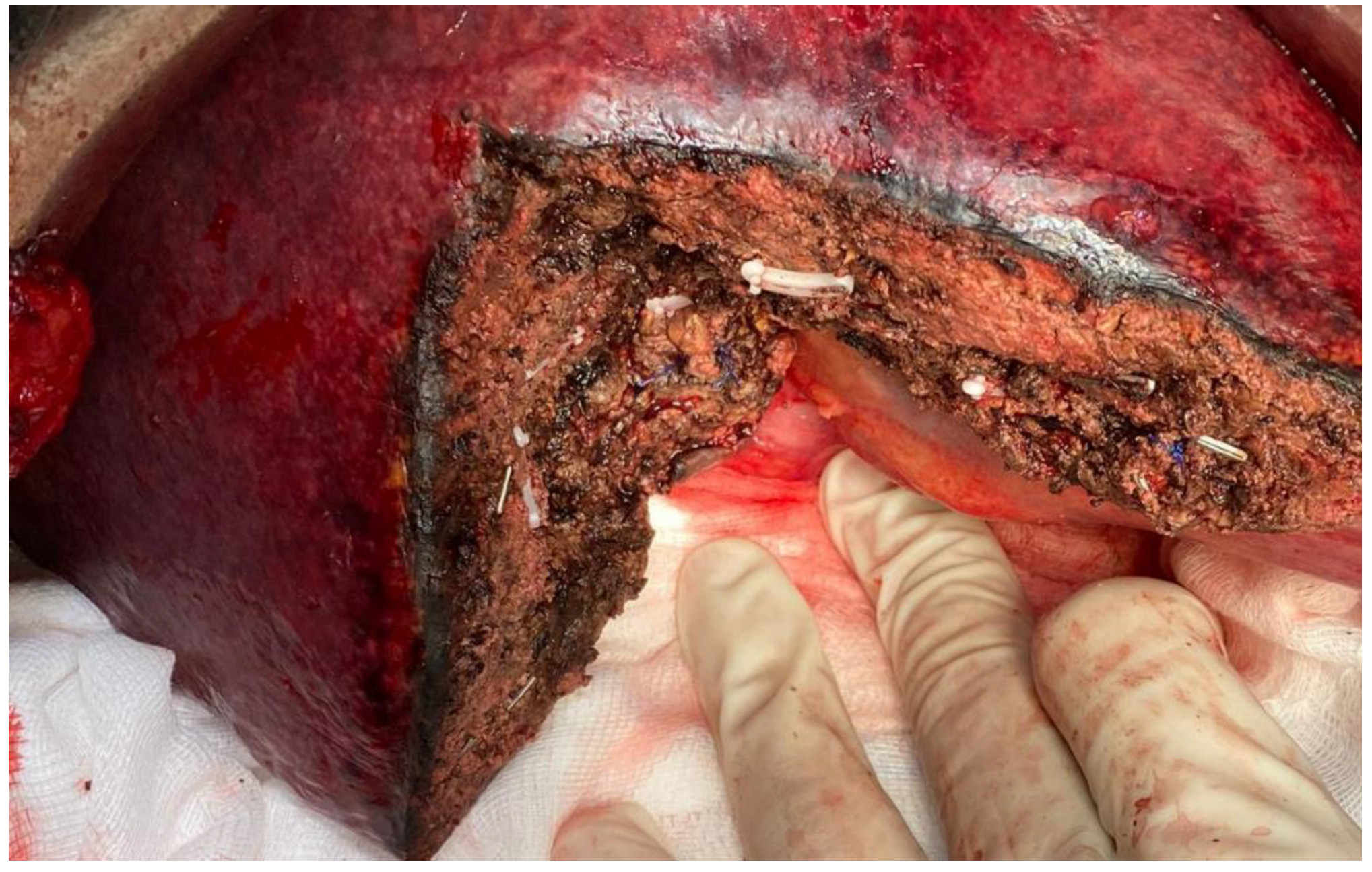 Jpm 13 00134 g001 Jpm 13 00134 g001