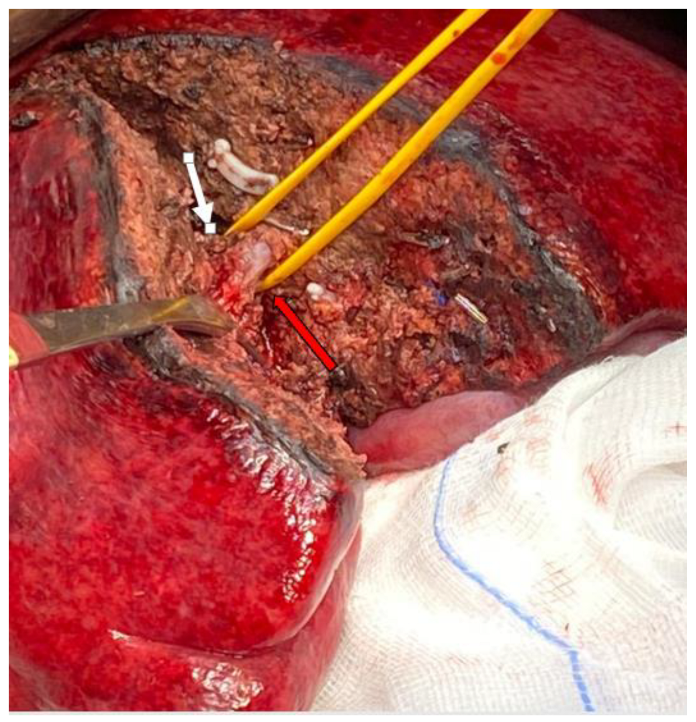 Jpm 13 00134 g002 Jpm 13 00134 g002