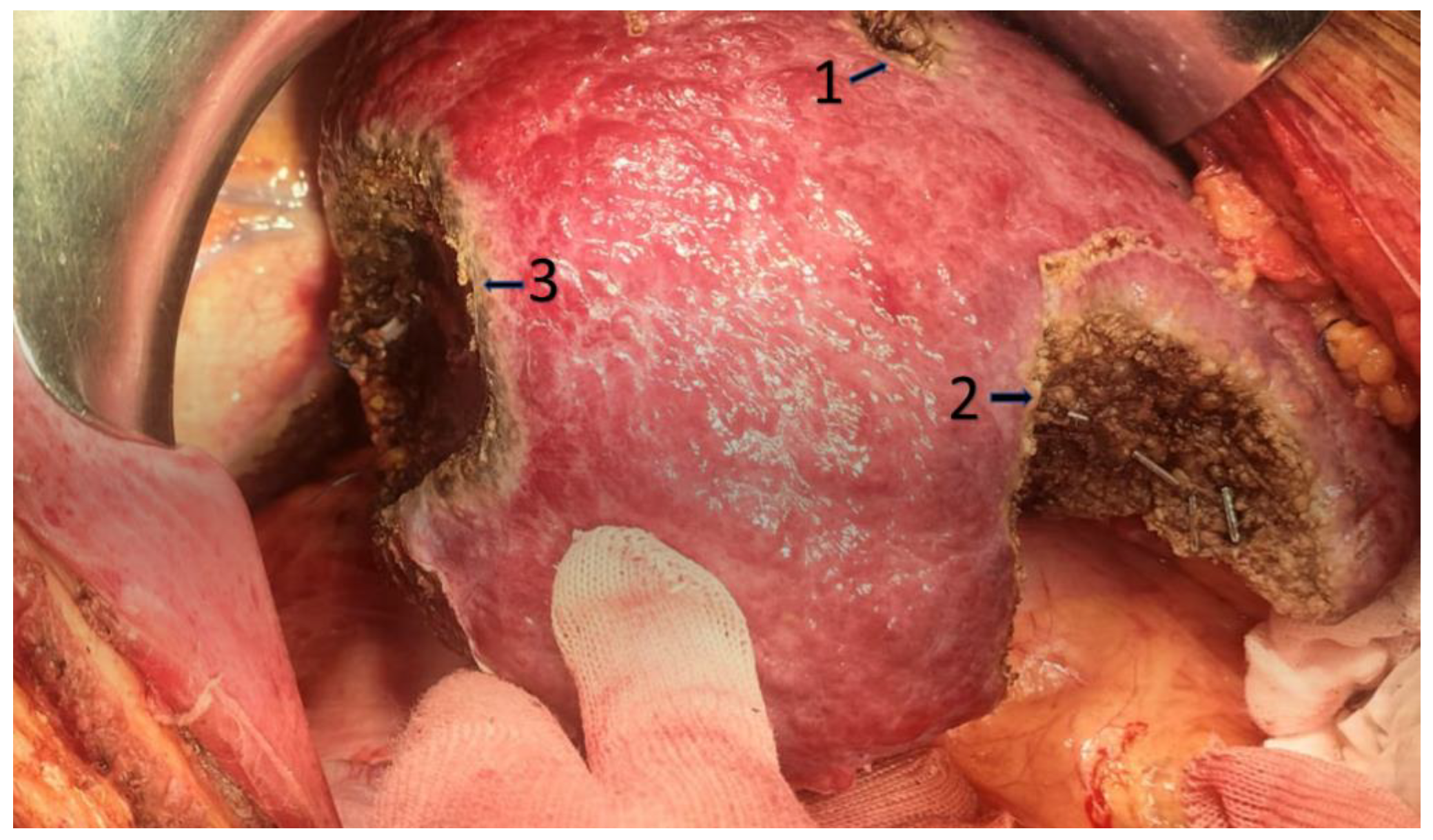 Jpm 13 00134 g003 Jpm 13 00134 g003