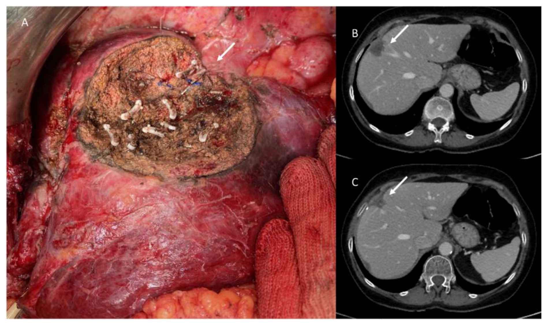 Jpm 13 00134 g005 Jpm 13 00134 g005