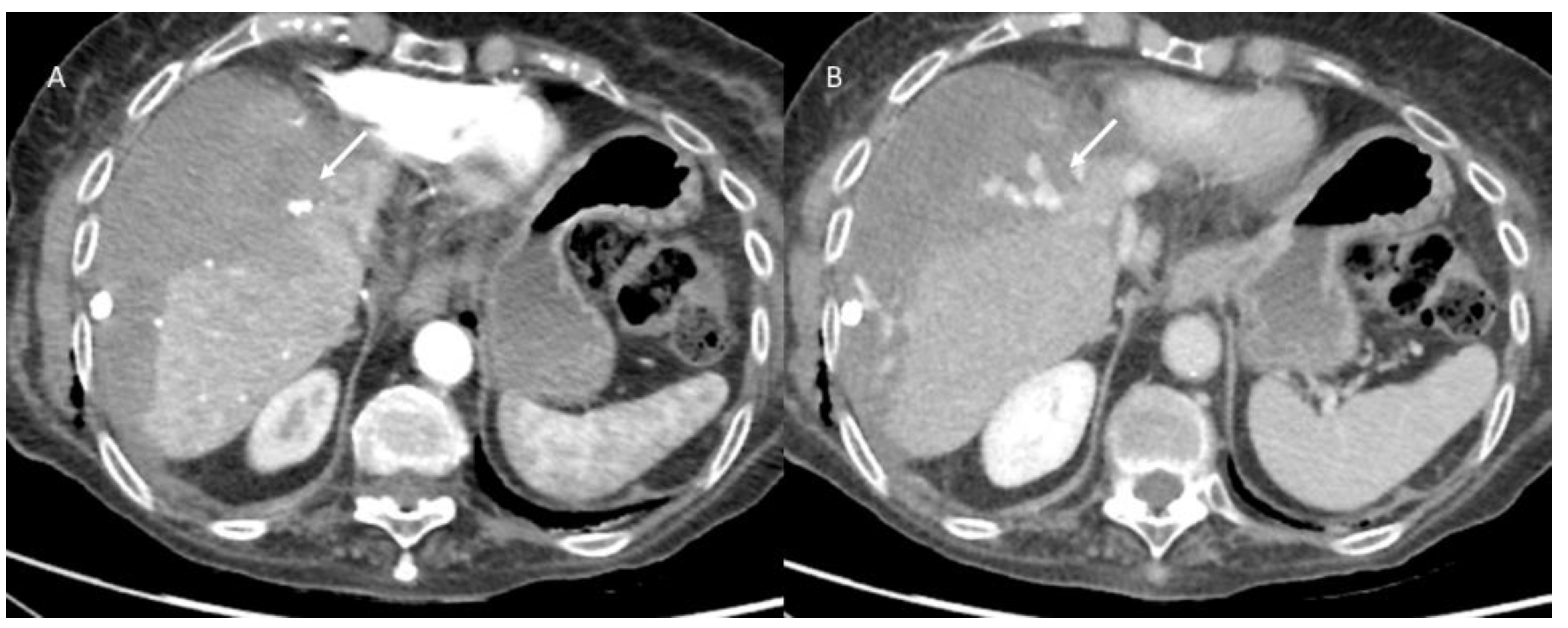 Jpm 13 00134 g006 Jpm 13 00134 g006