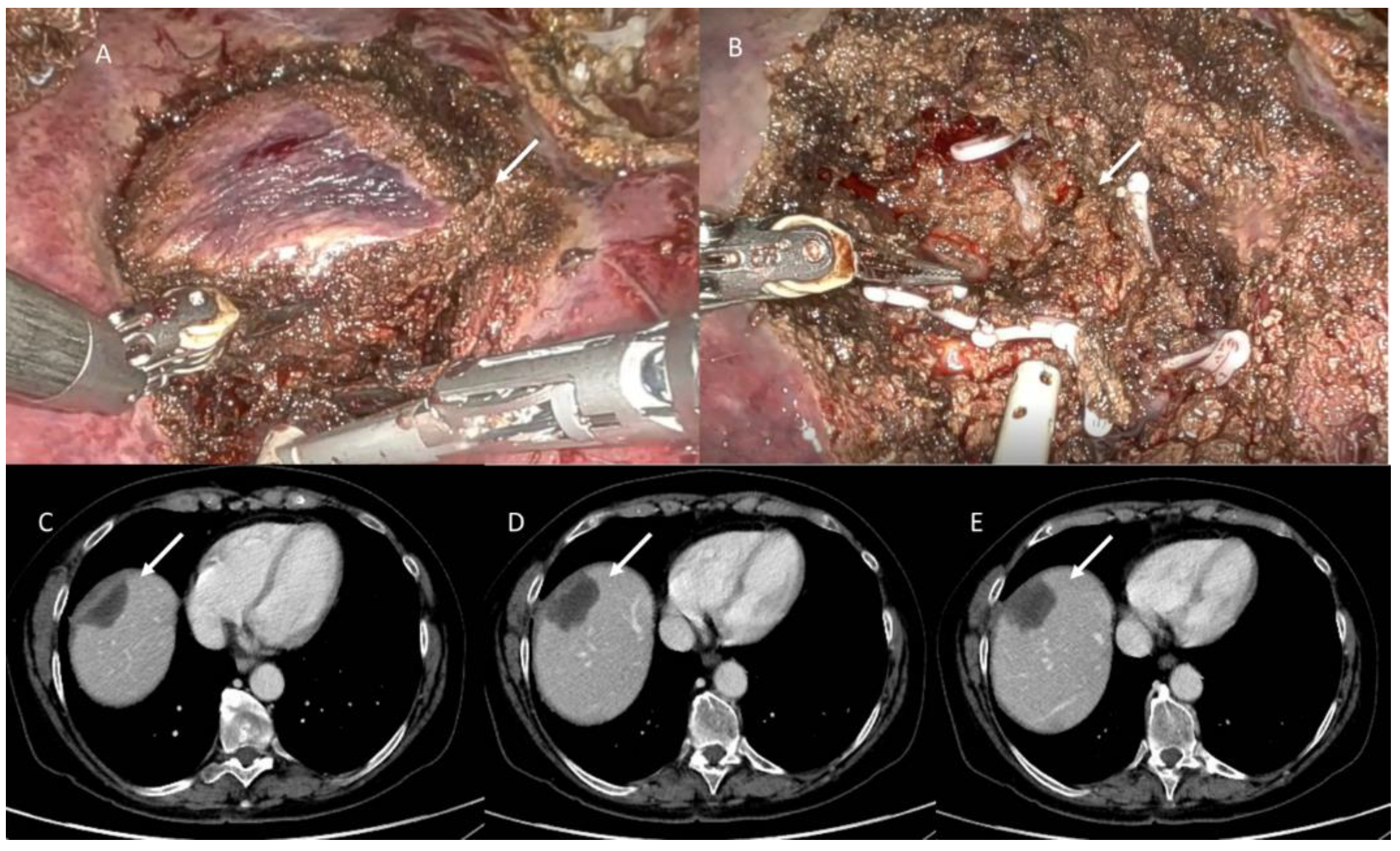 Jpm 13 00134 g008 Jpm 13 00134 g008