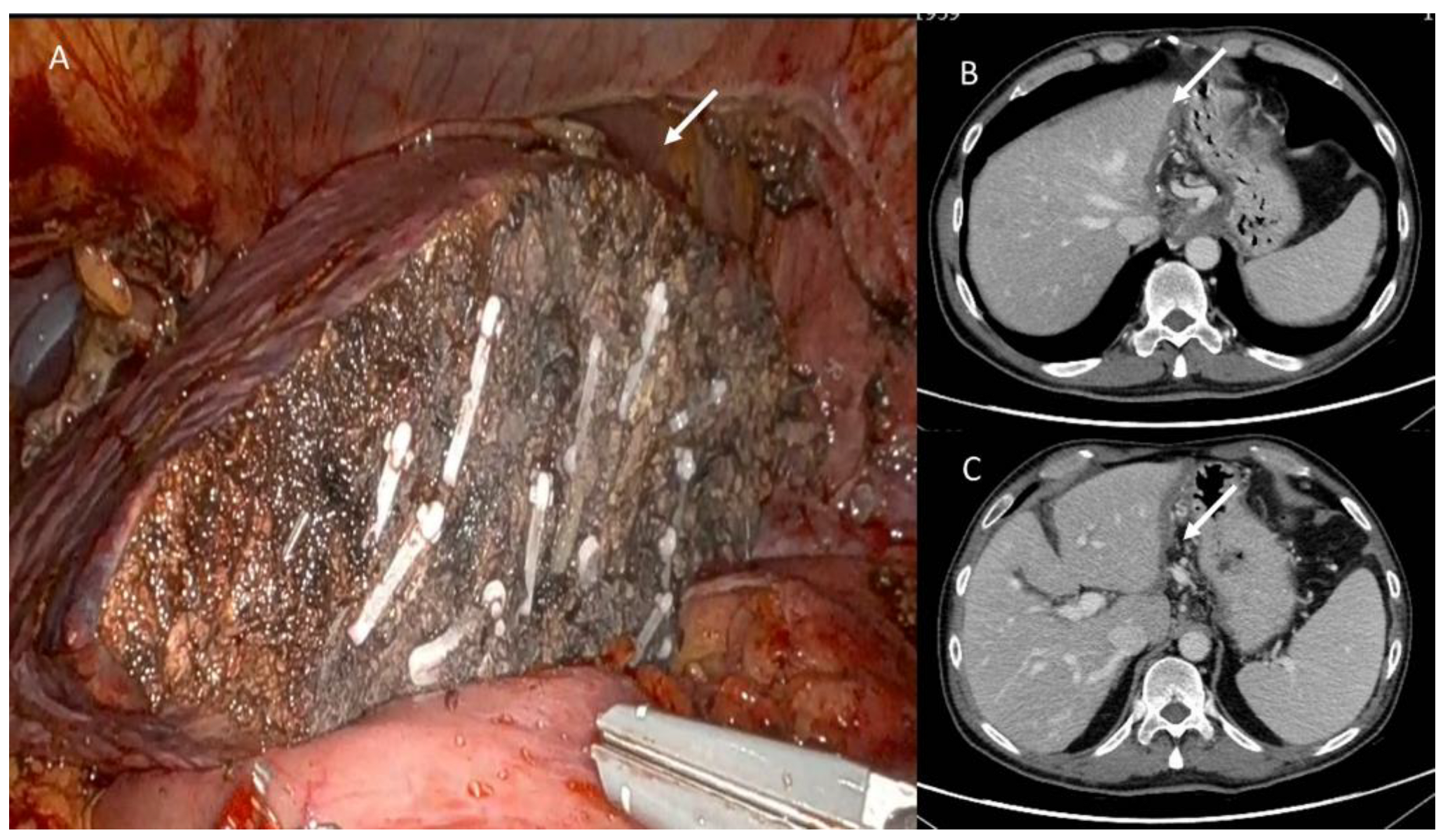Jpm 13 00134 g009 Jpm 13 00134 g009