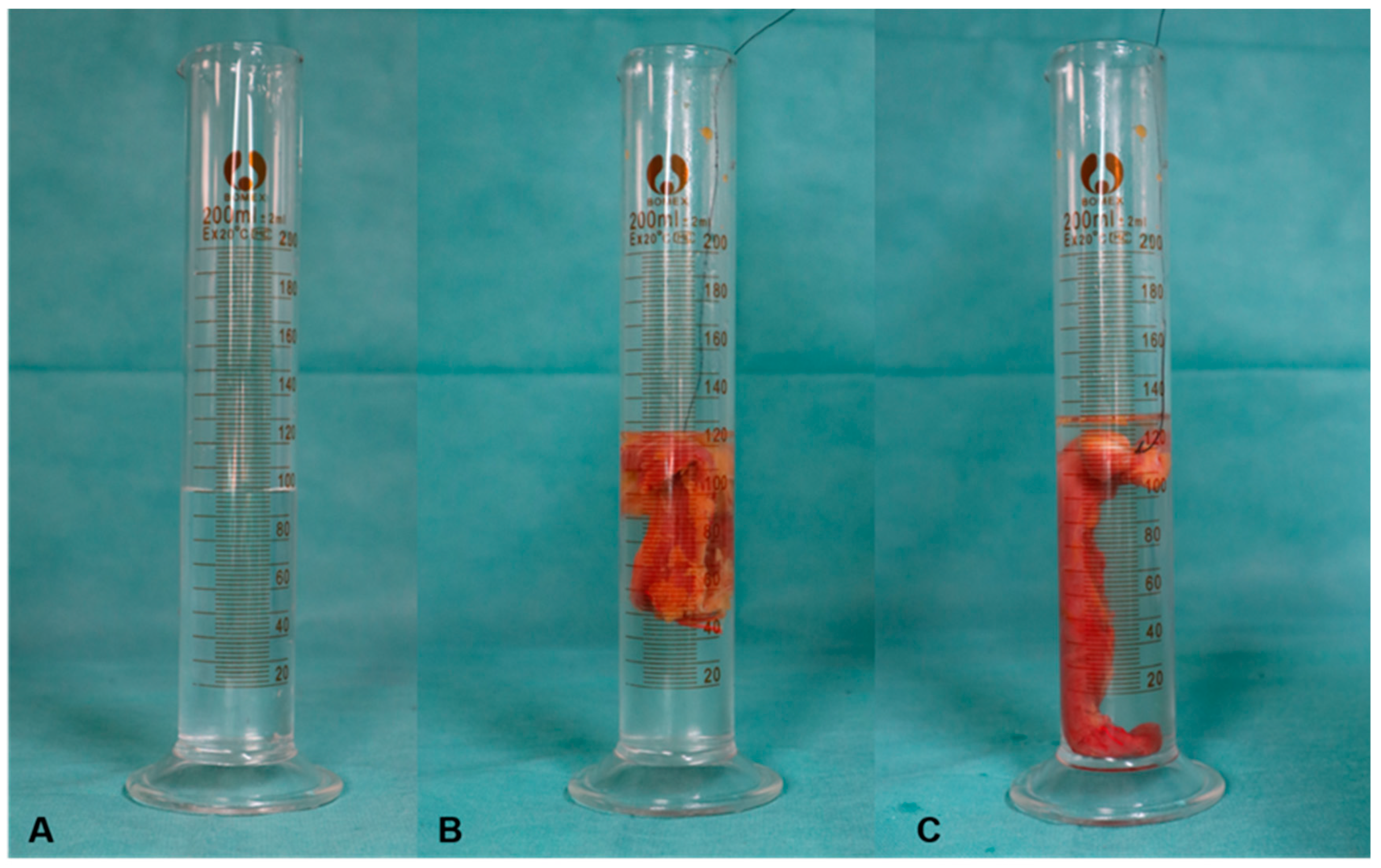 Jpm 13 00143 g004 Jpm 13 00143 g004