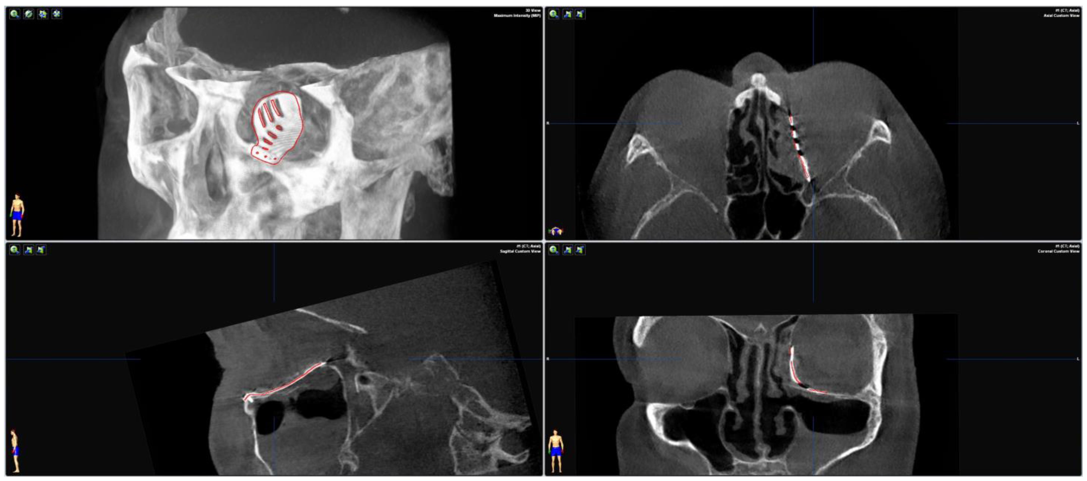 Jpm 13 00148 g004 Jpm 13 00148 g004