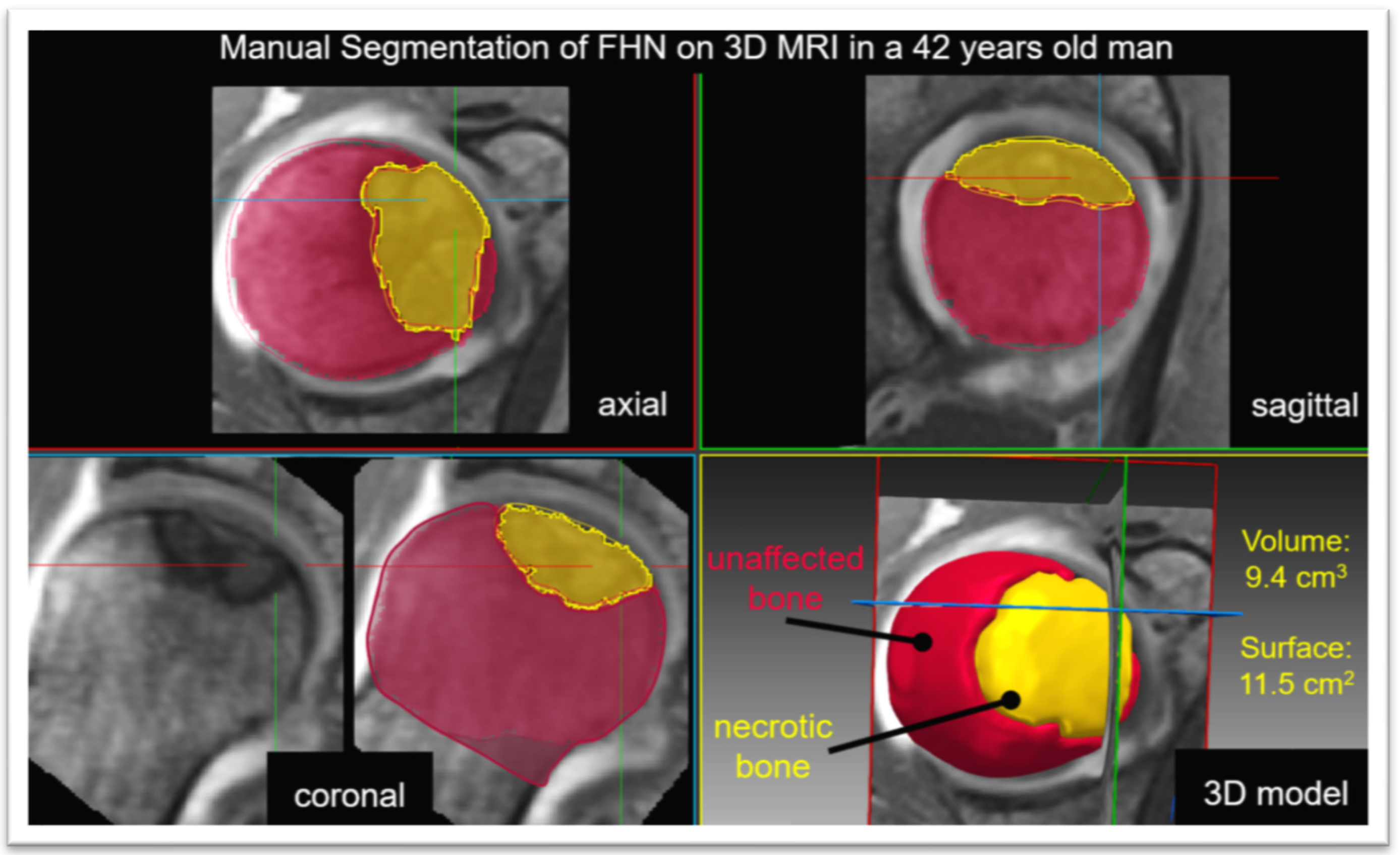 JPM Free FullText A Deep Learning Method for Quantification of
