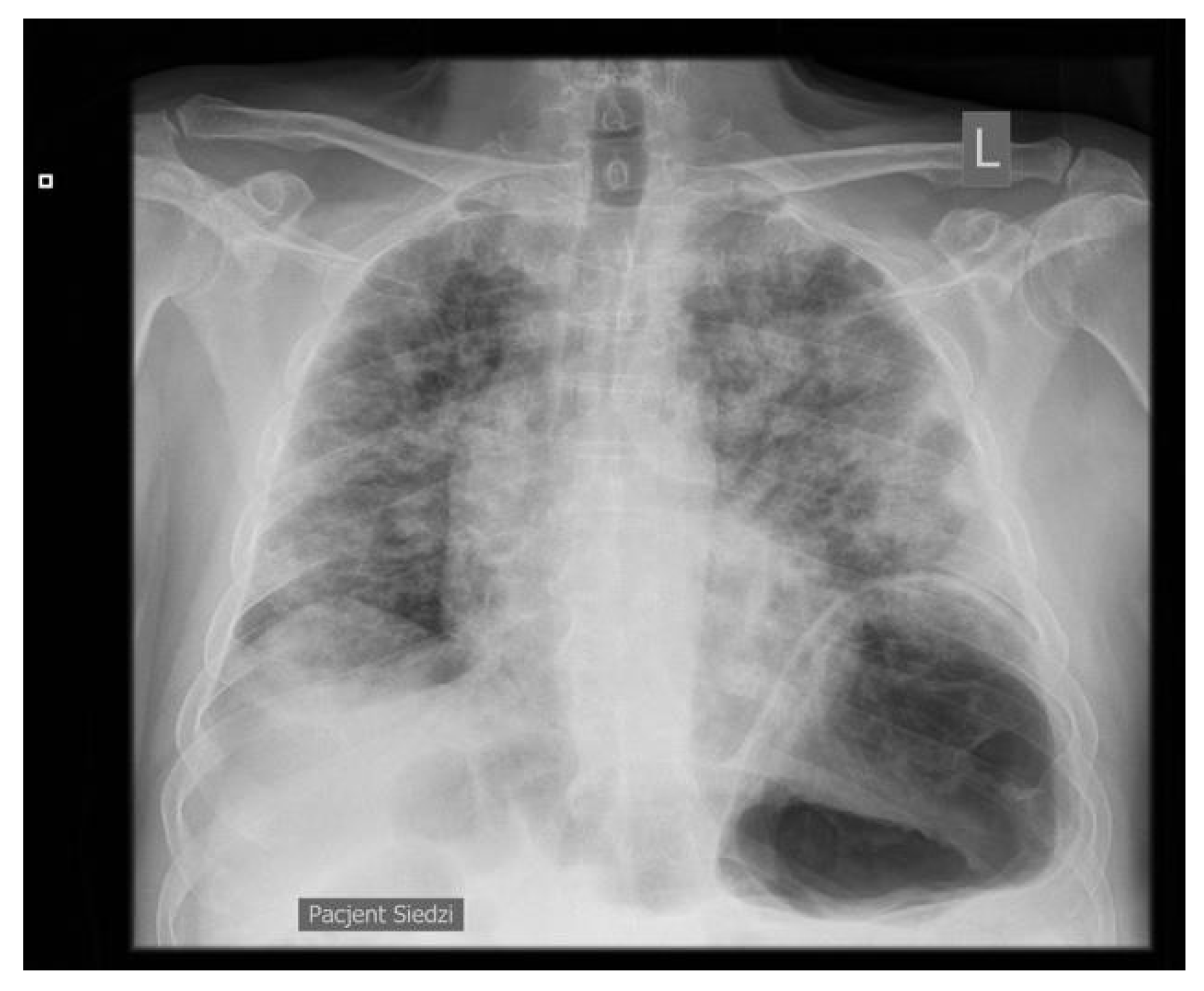 Jpm 13 00178 g001 550