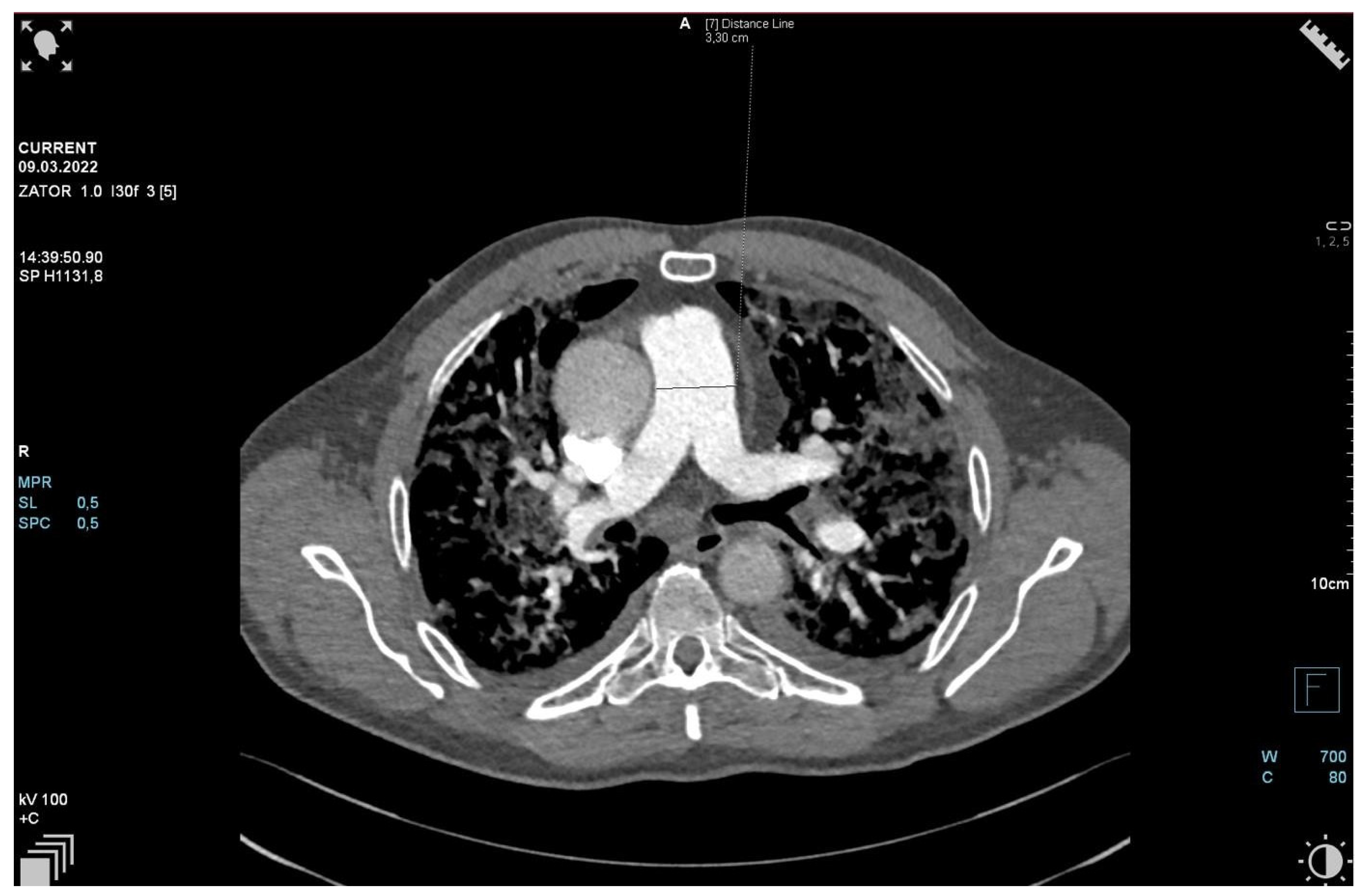 Jpm 13 00178 g002 550