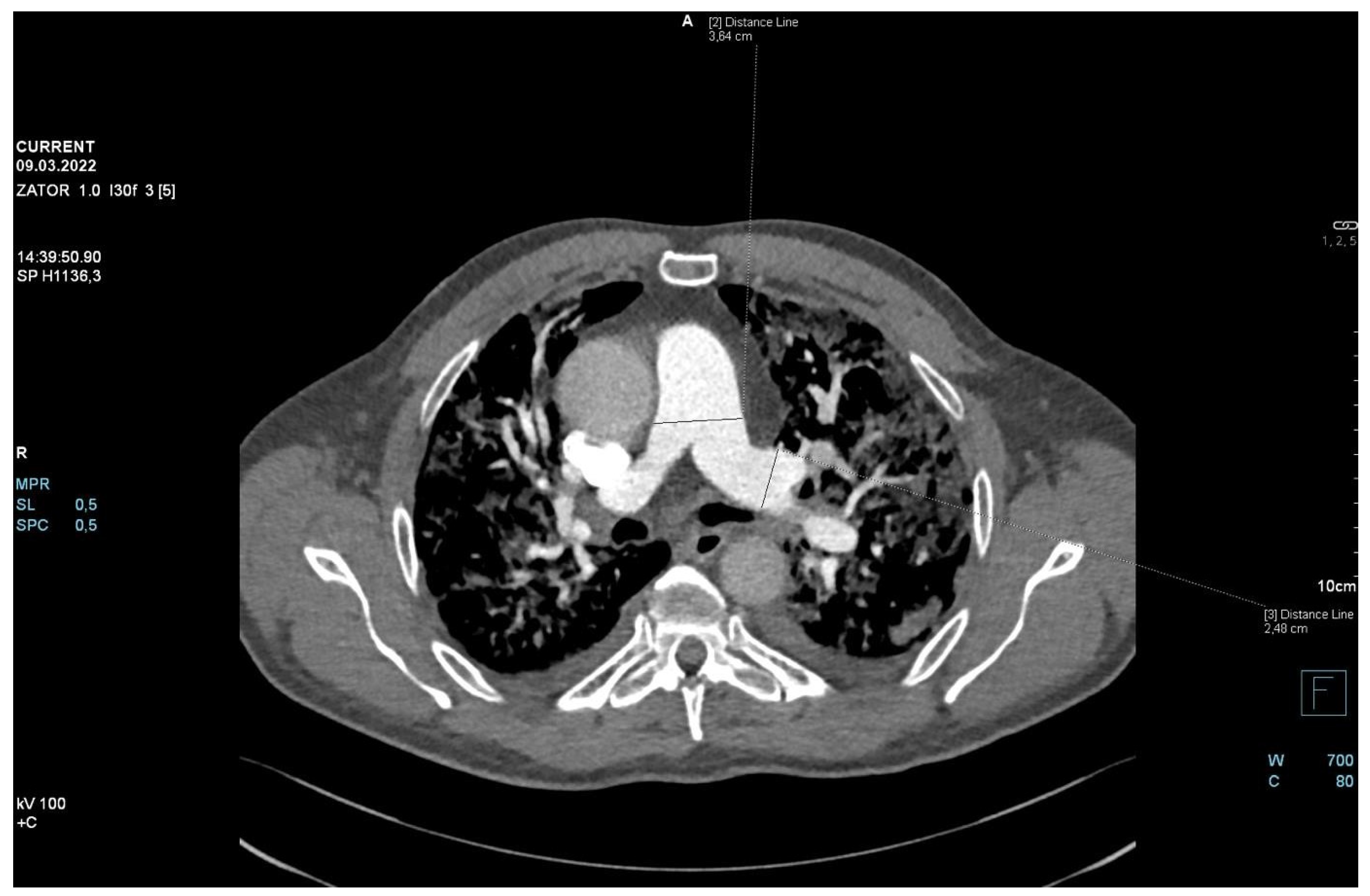 Jpm 13 00178 g003 550
