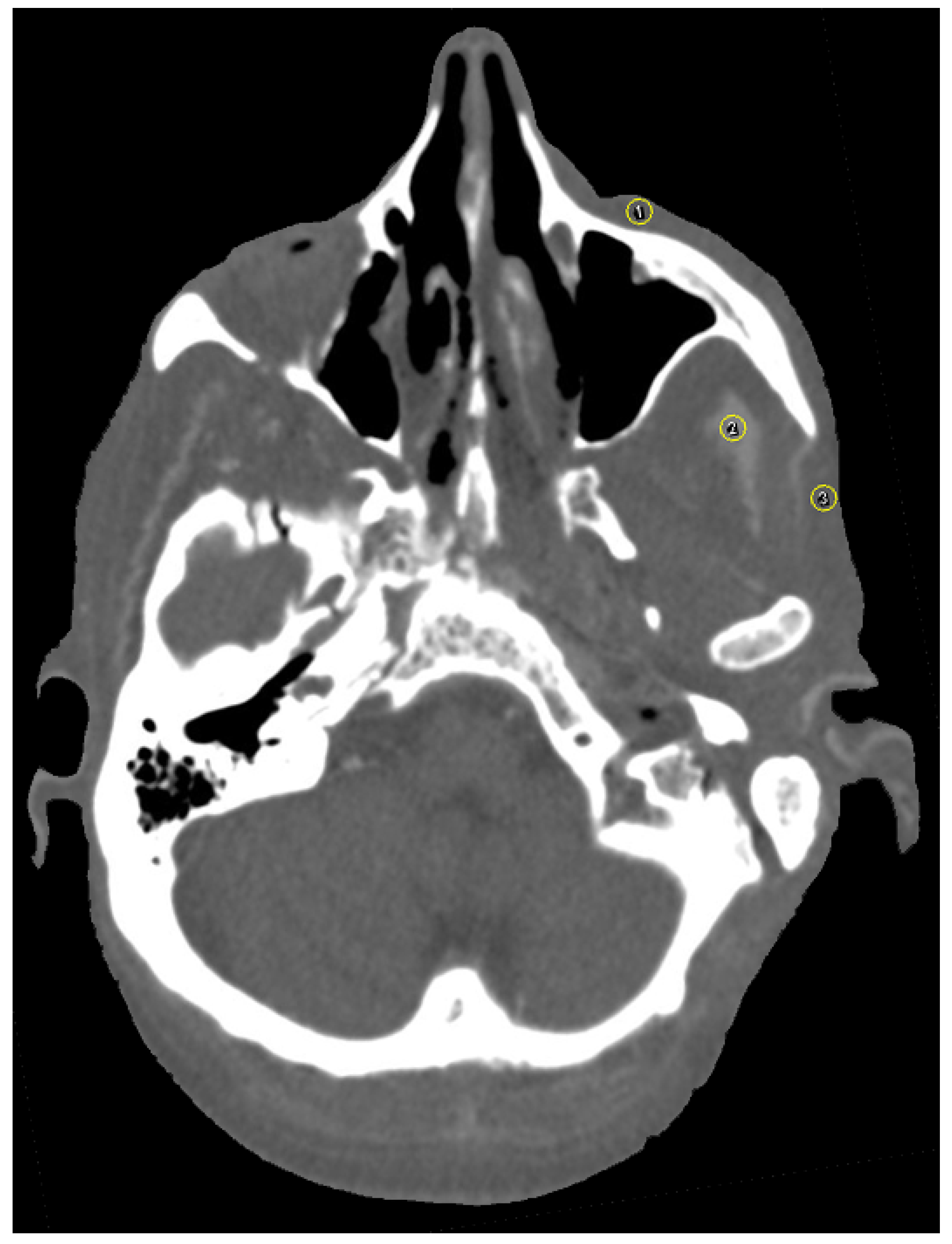 Jpm 13 00236 g004 Jpm 13 00236 g004