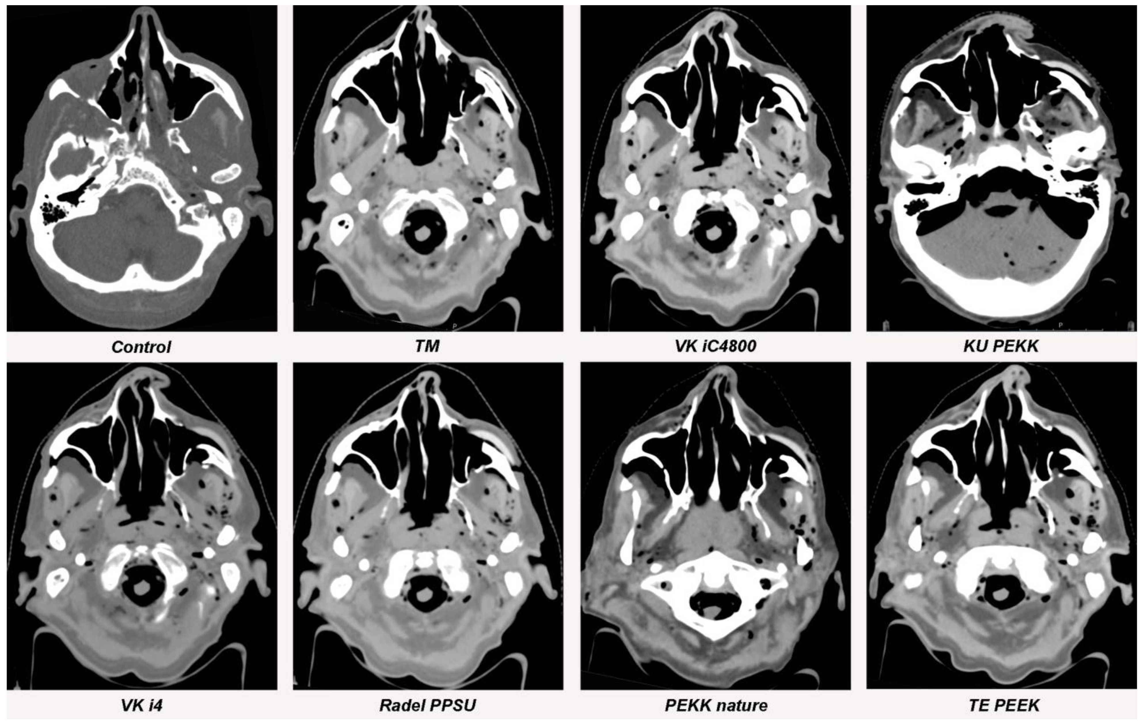 Jpm 13 00236 g005 Jpm 13 00236 g005