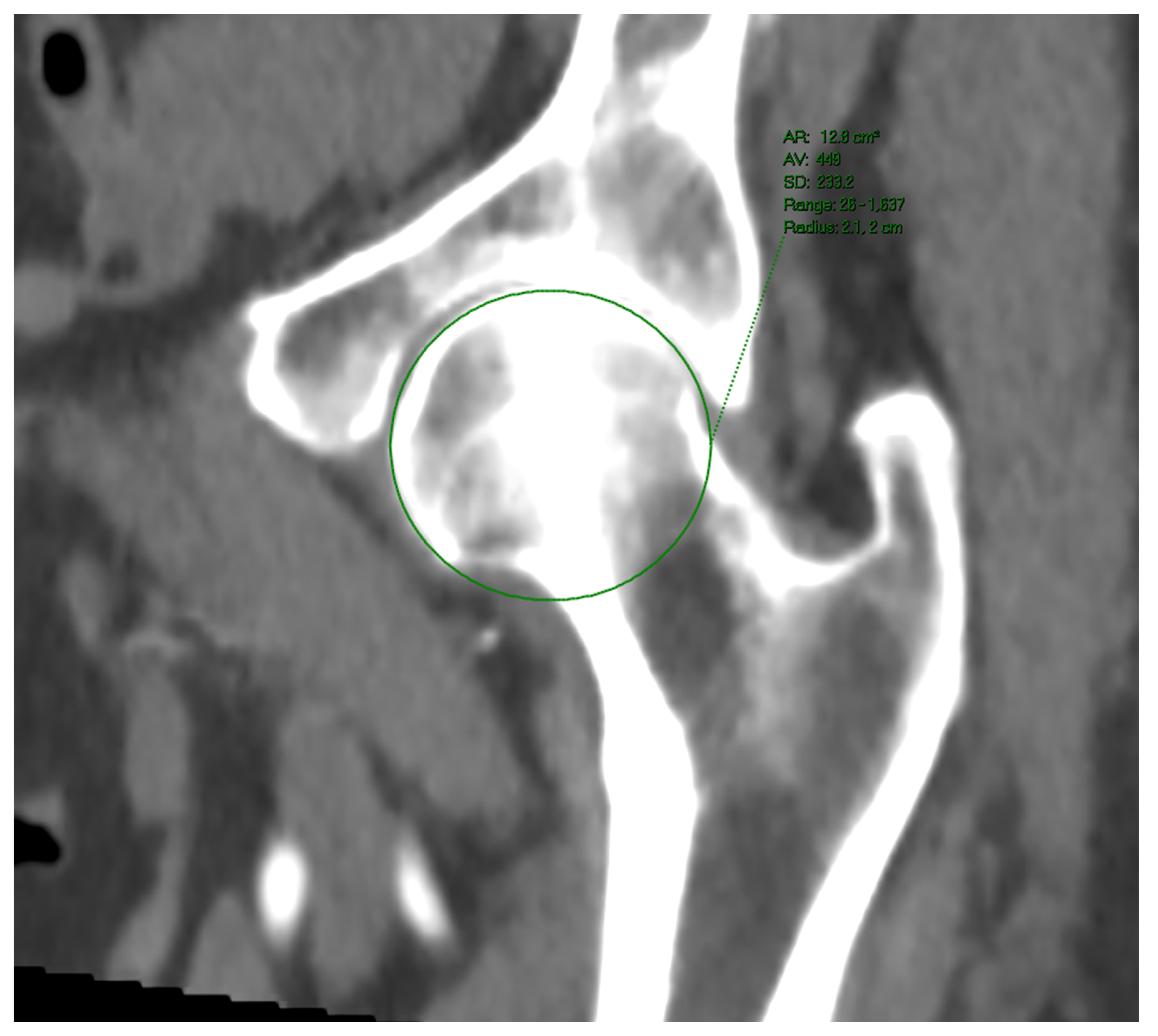 Jpm 13 00254 g003 Jpm 13 00254 g003