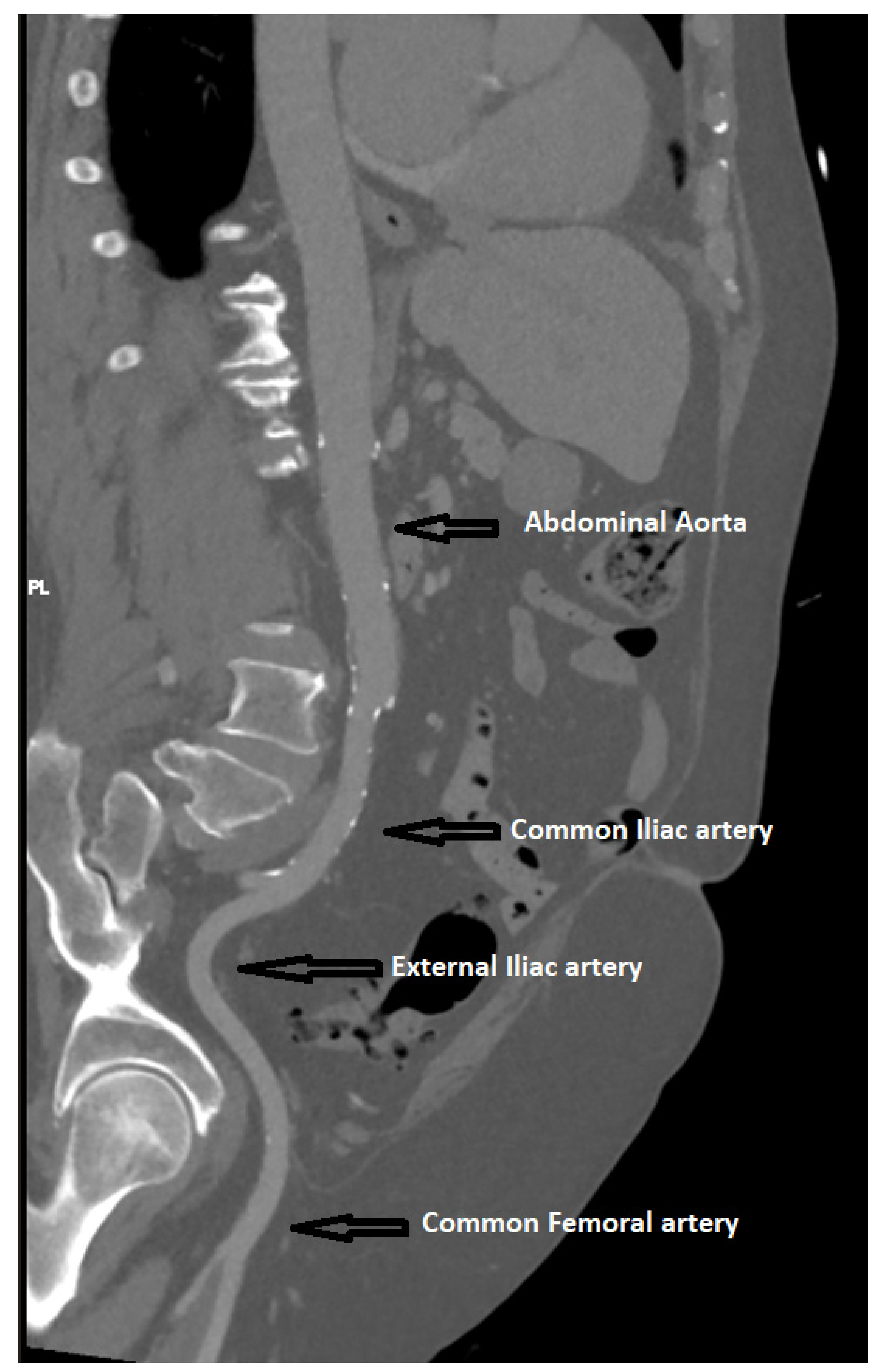 Jpm 13 00254 g004 Jpm 13 00254 g004