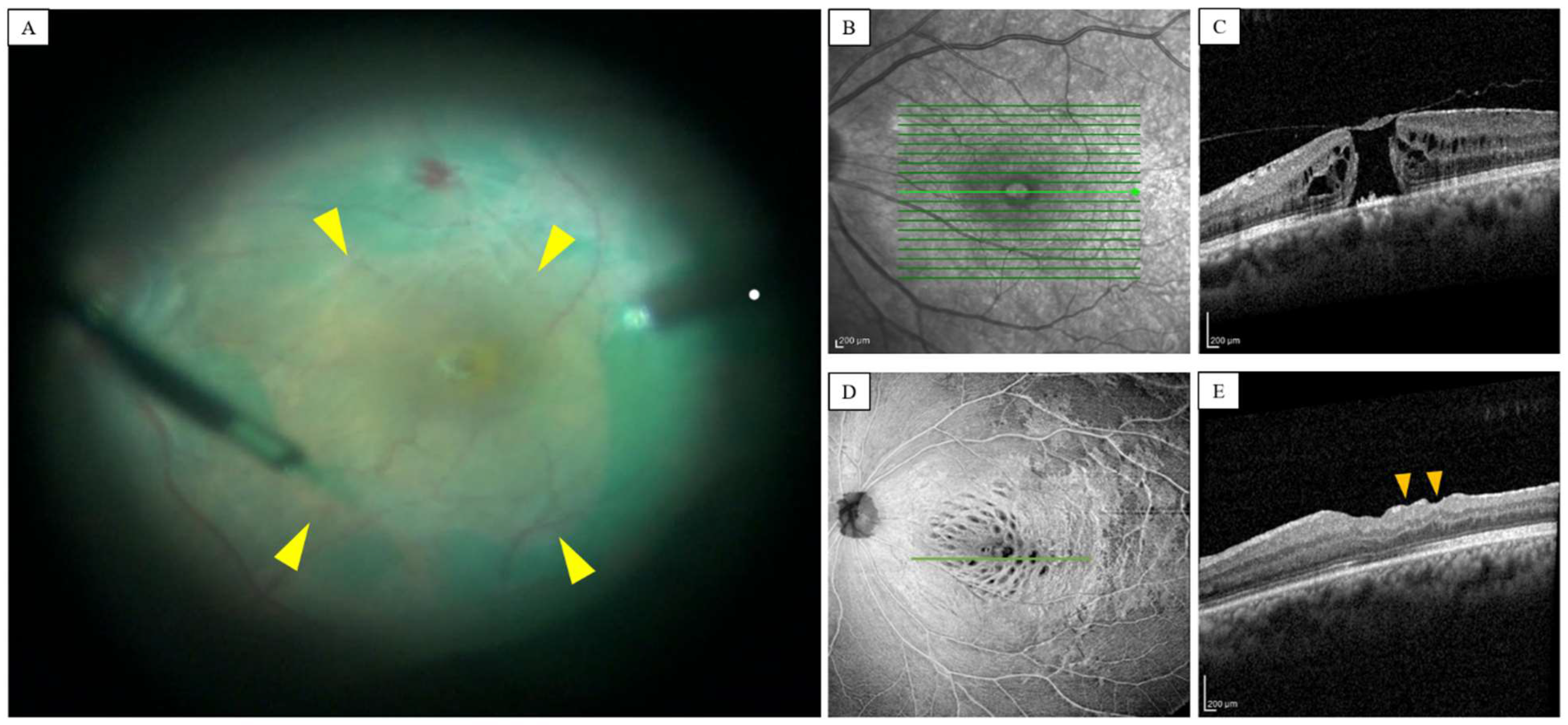 Jpm 13 00255 g001 Jpm 13 00255 g001