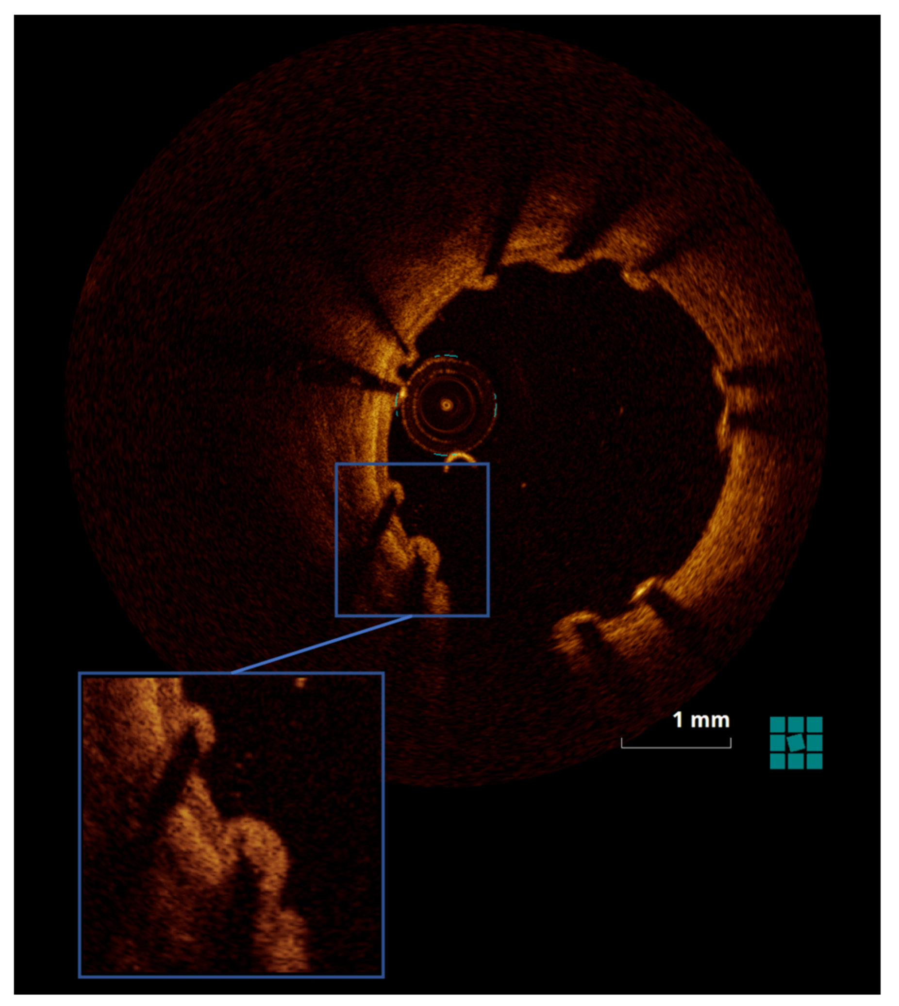 Jpm 13 00280 g003 Jpm 13 00280 g003