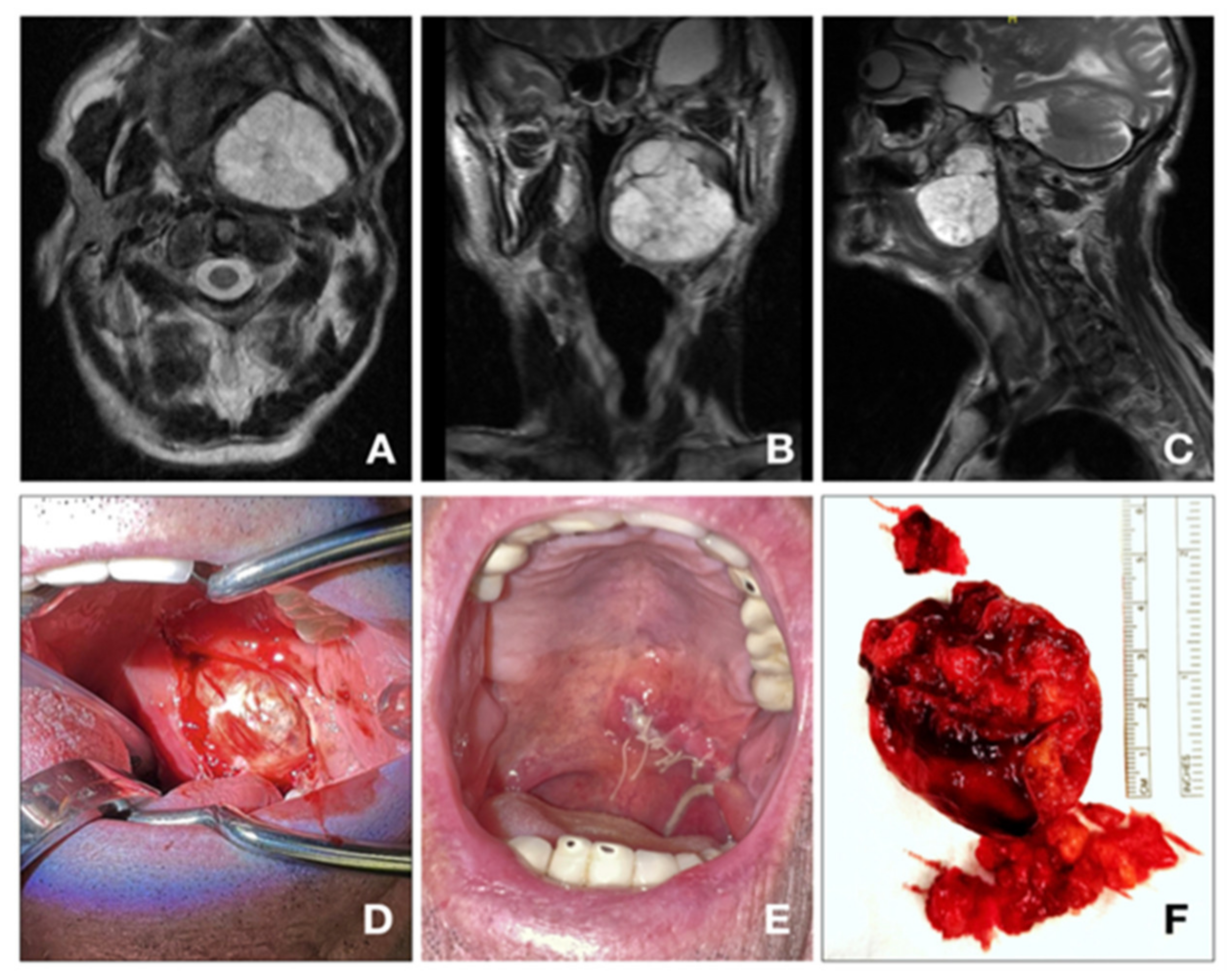 Jpm 13 00283 g003 Jpm 13 00283 g003