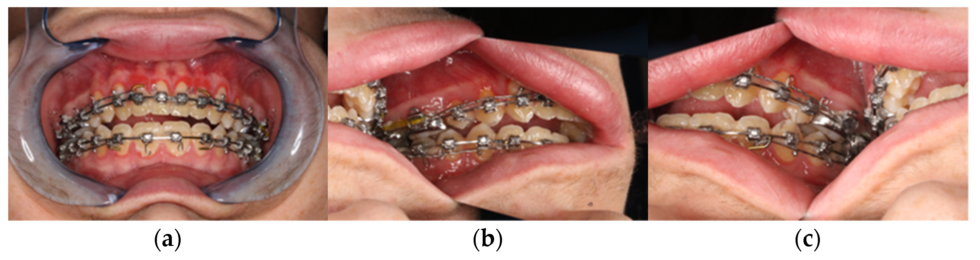 Jpm 13 00287 g002 550