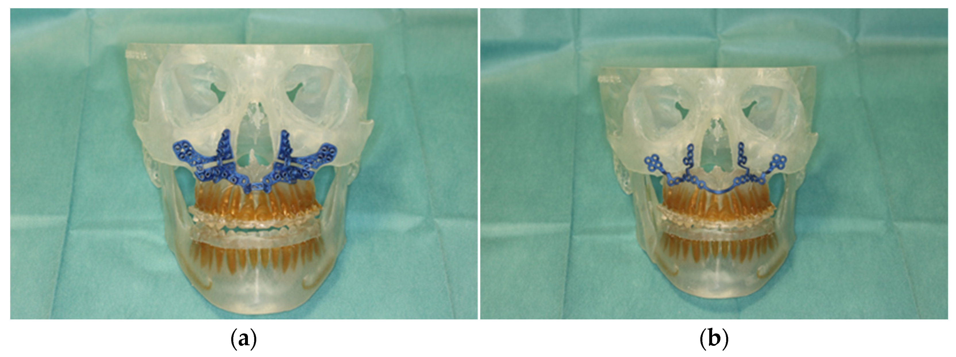 Jpm 13 00287 g003 550