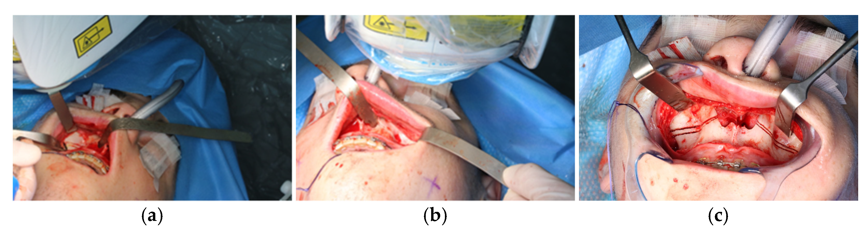 Jpm 13 00287 g008 550