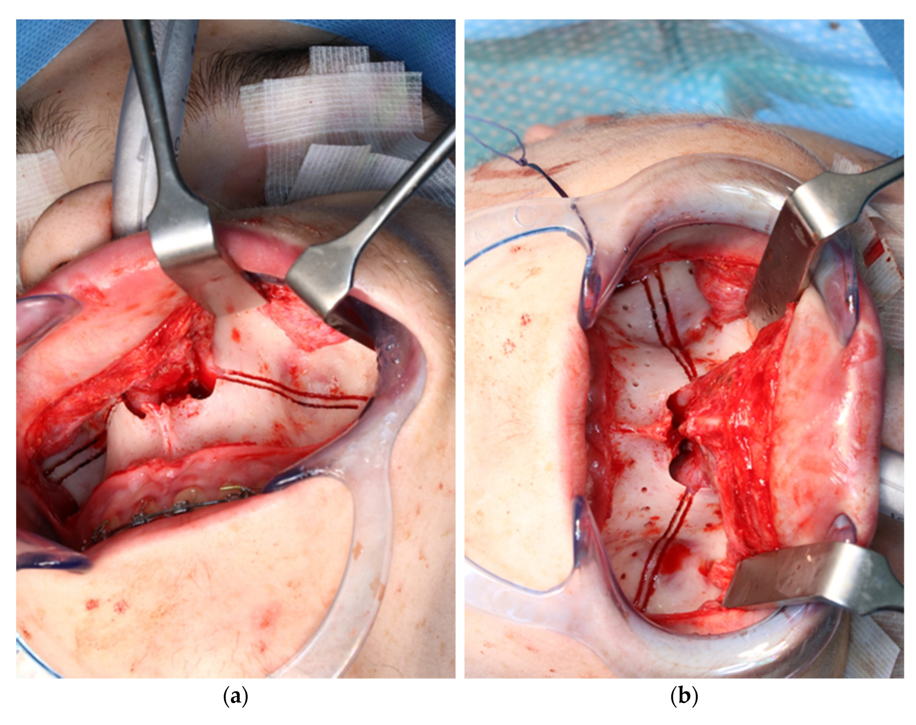 Jpm 13 00287 g009 550