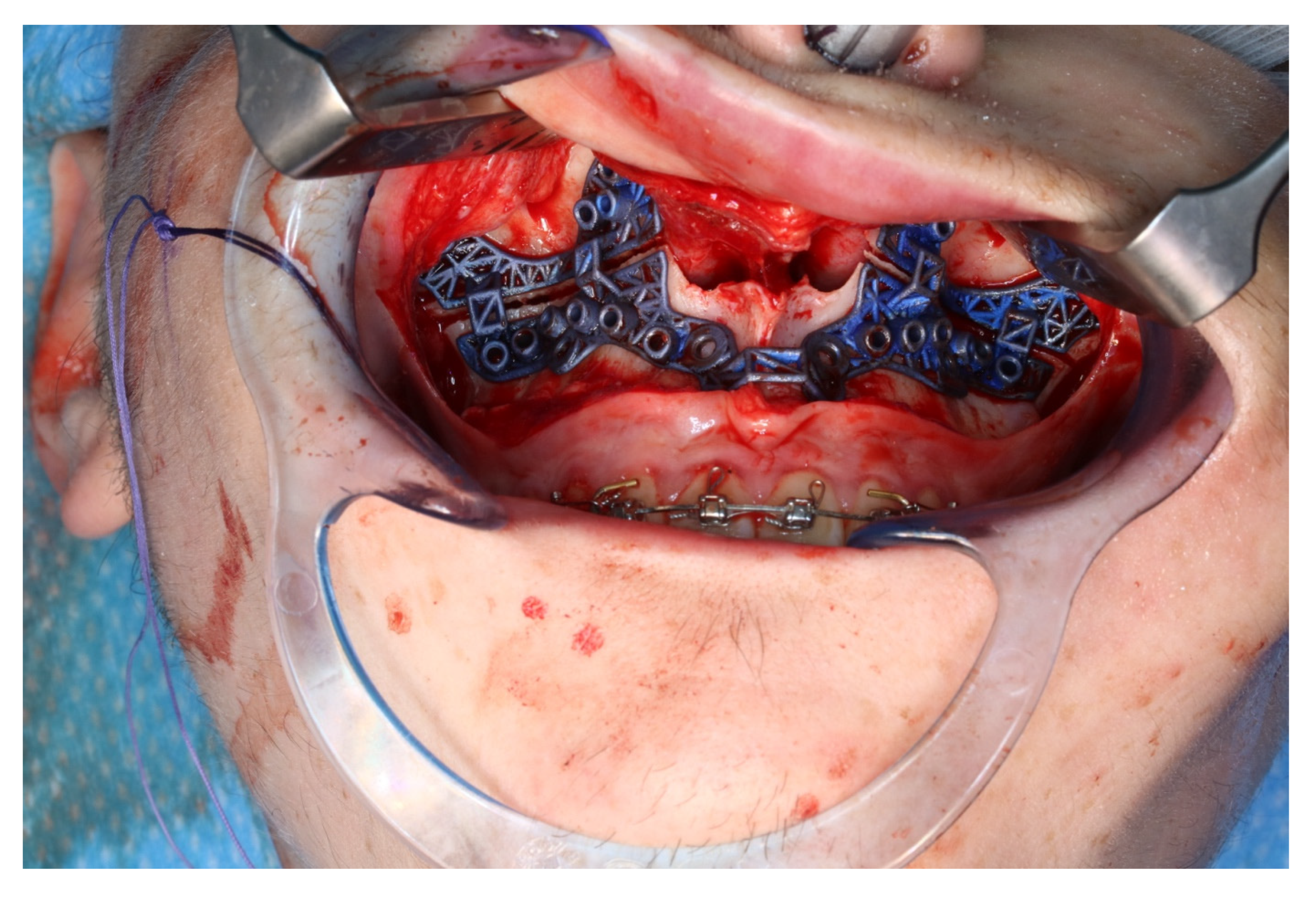 Jpm 13 00287 g010 550