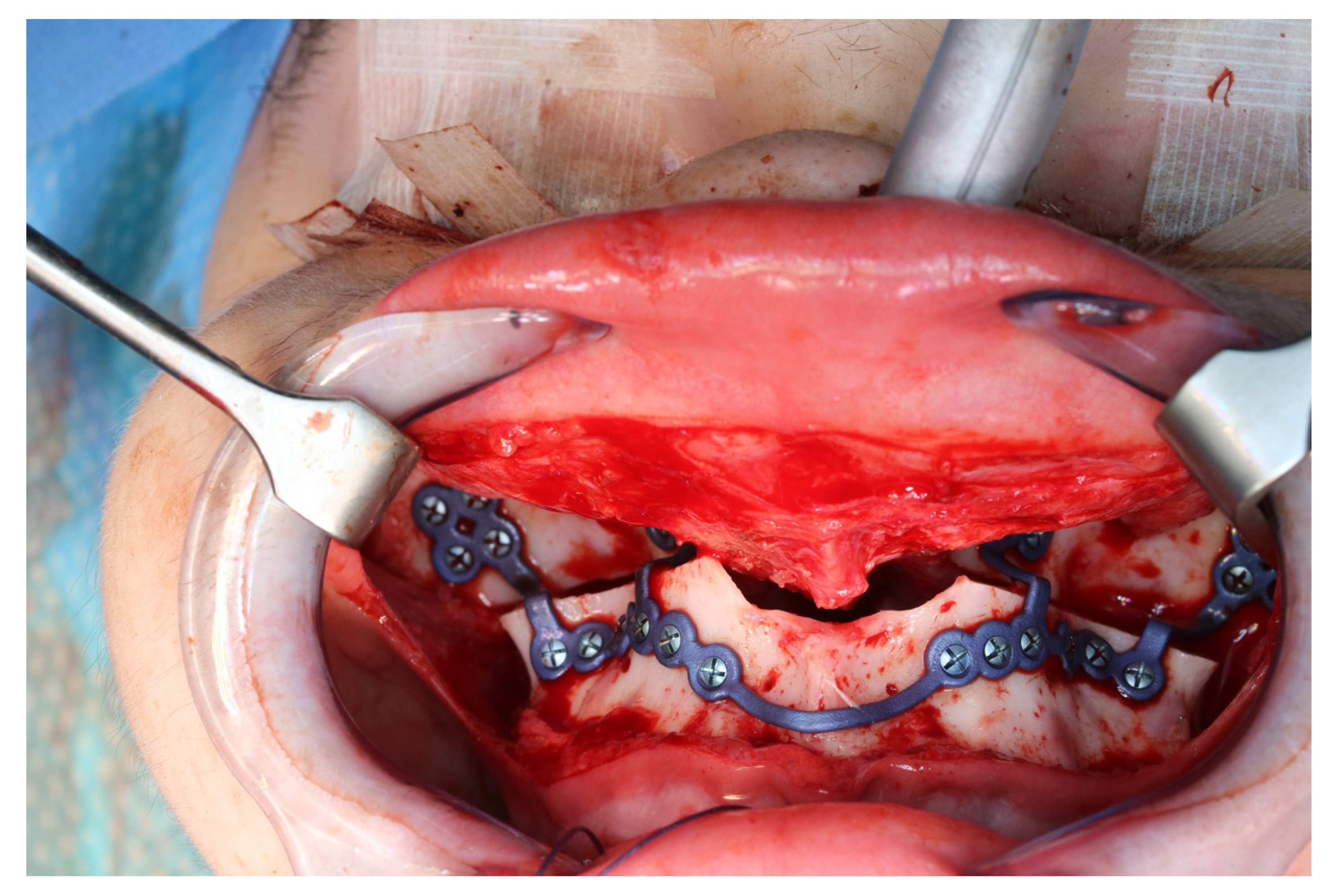 Jpm 13 00287 g011 550