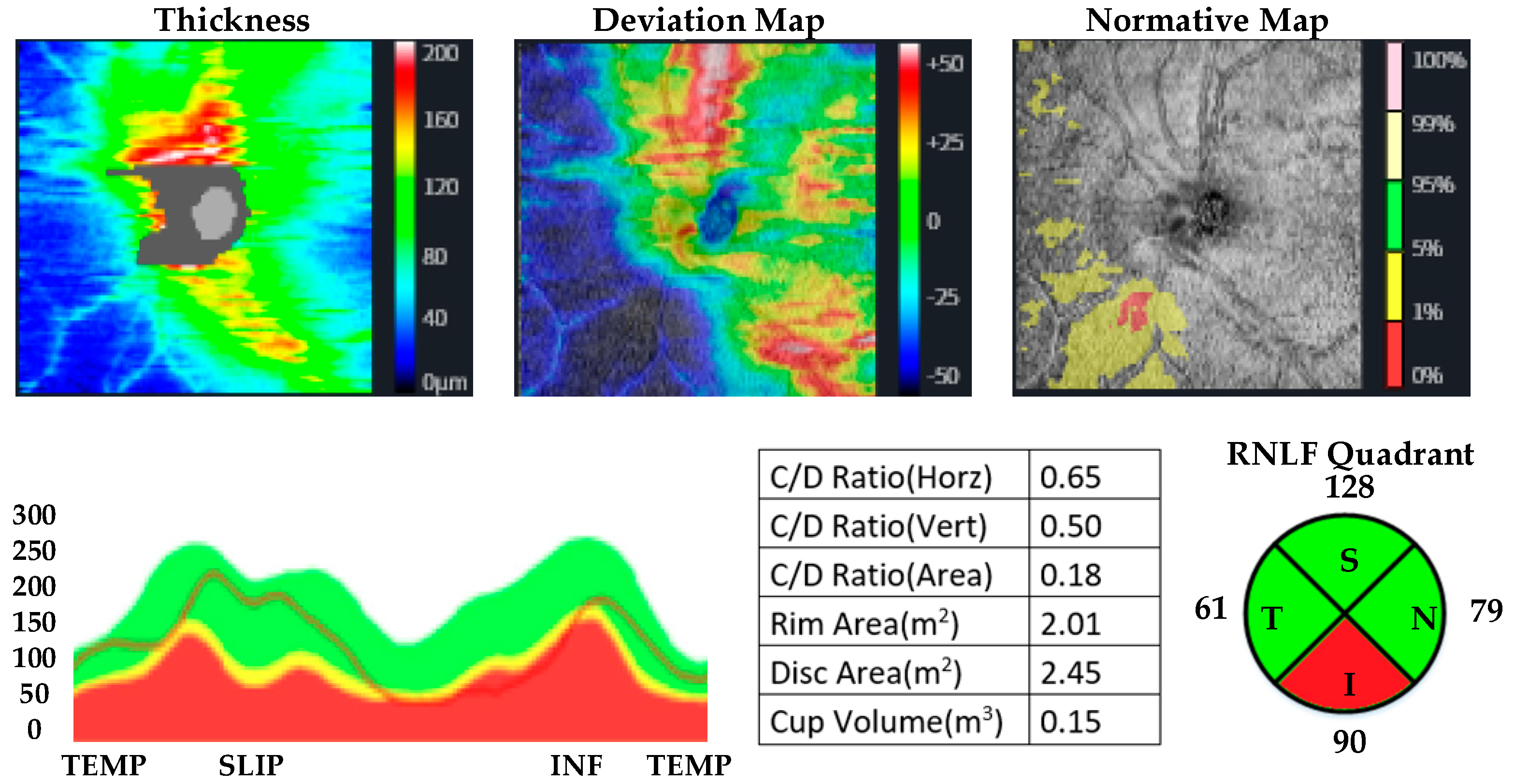Jpm 13 00308 g004 Jpm 13 00308 g004