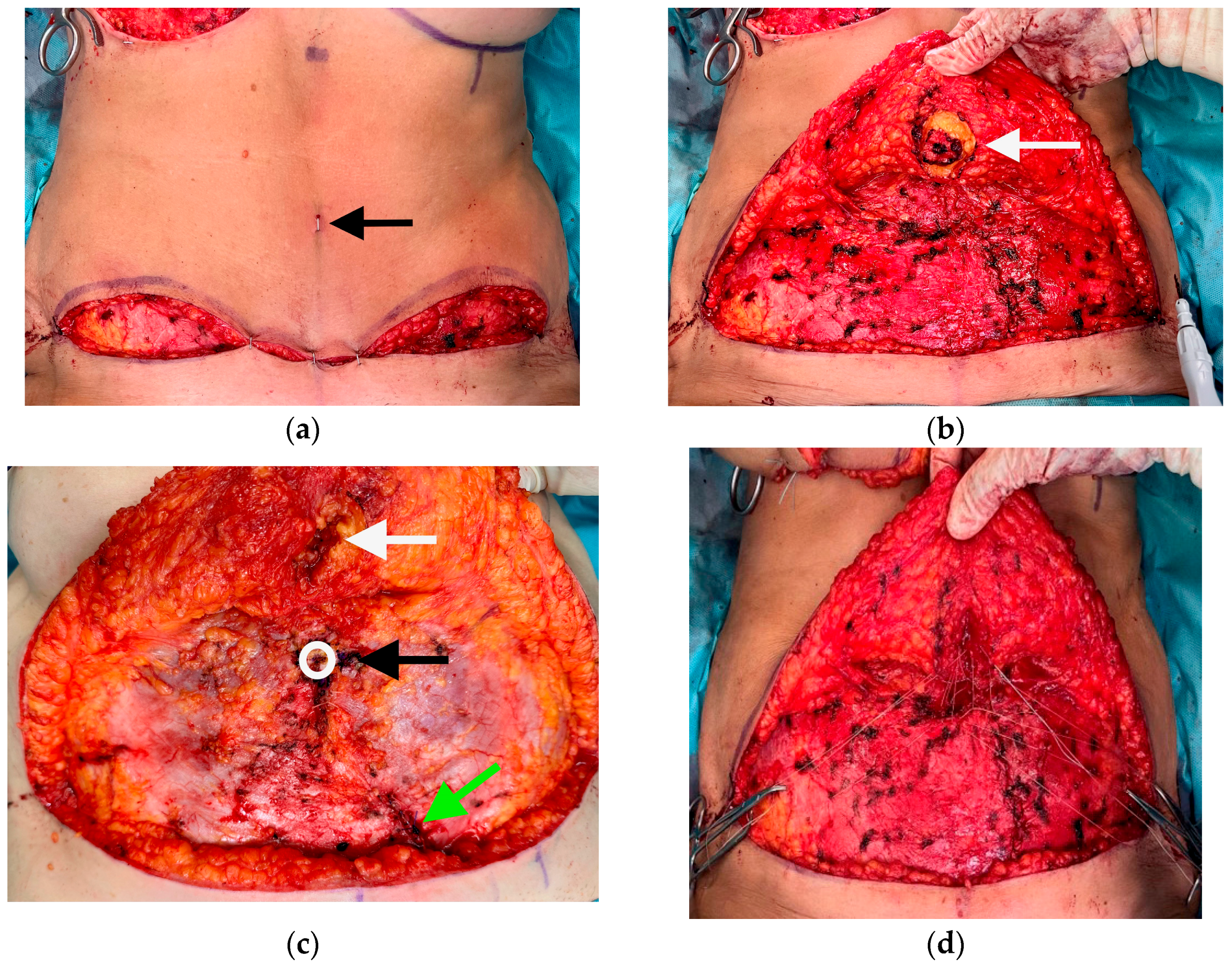 Jpm 13 00315 g002 550