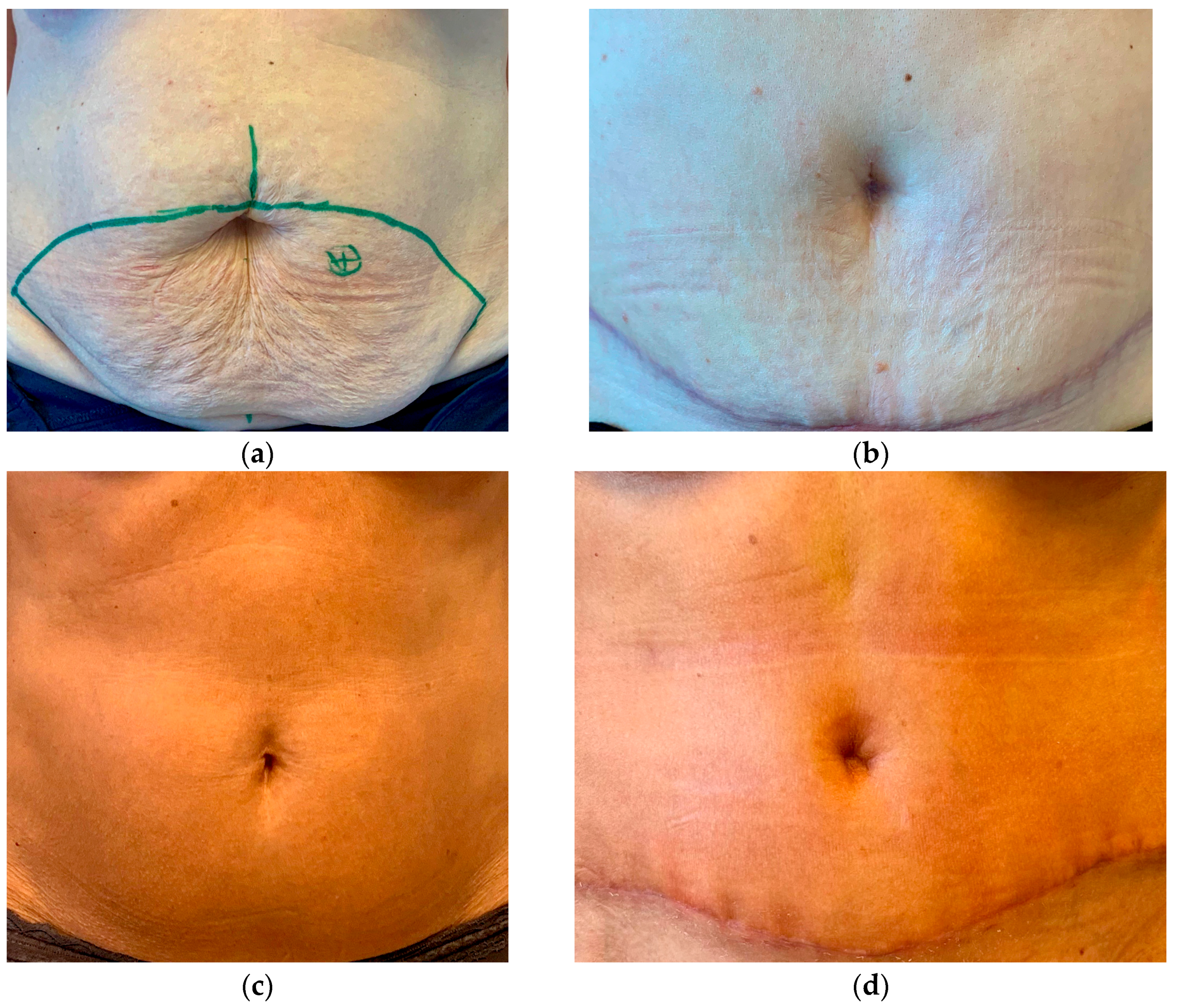 Jpm 13 00315 g003 550