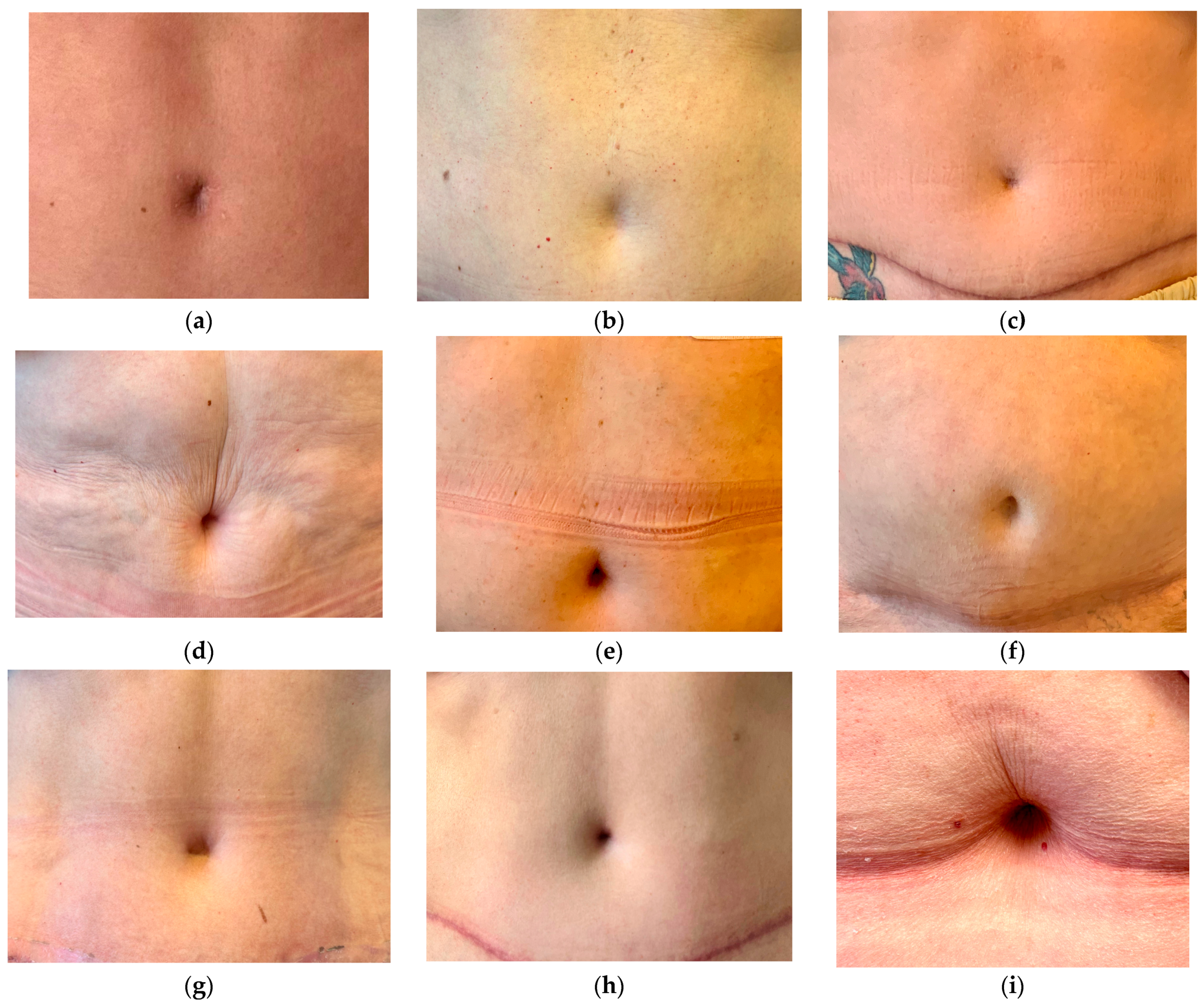 Jpm 13 00315 g005 550