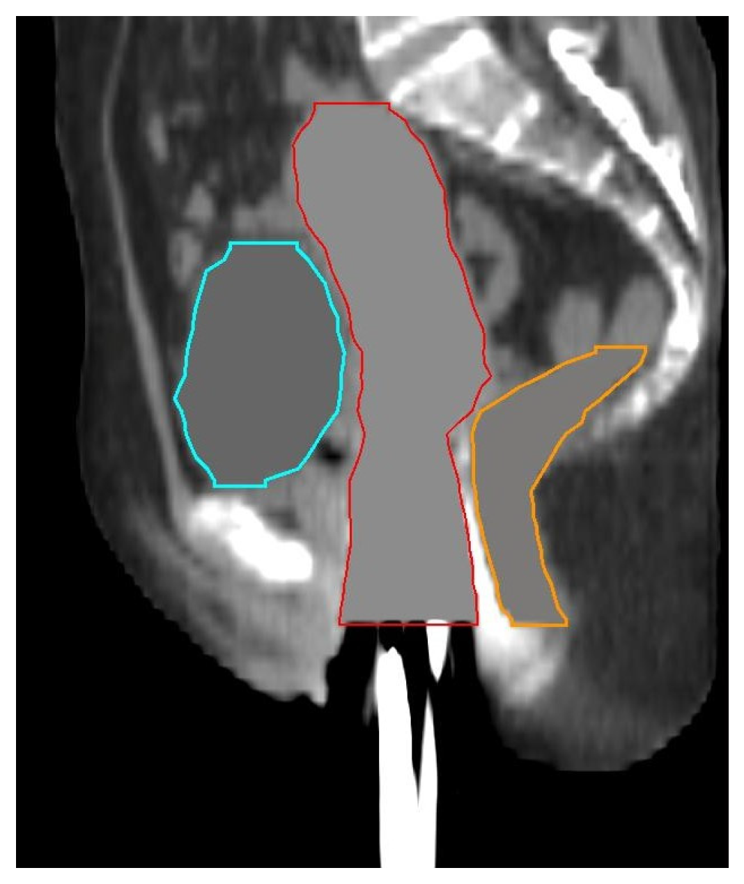 Jpm 13 00323 g001 Jpm 13 00323 g001