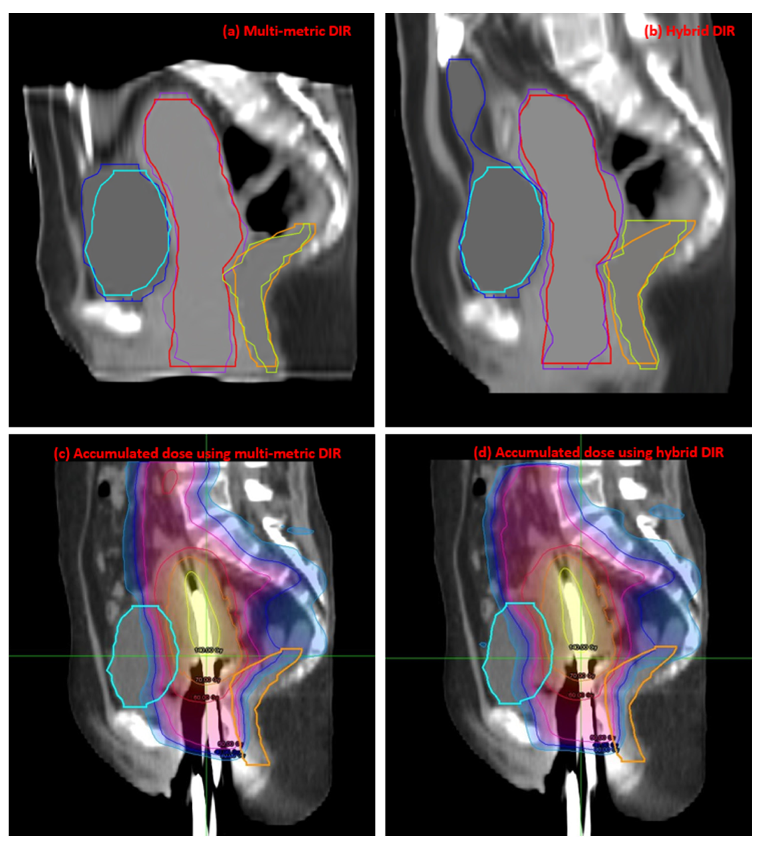 Jpm 13 00323 g005 Jpm 13 00323 g005