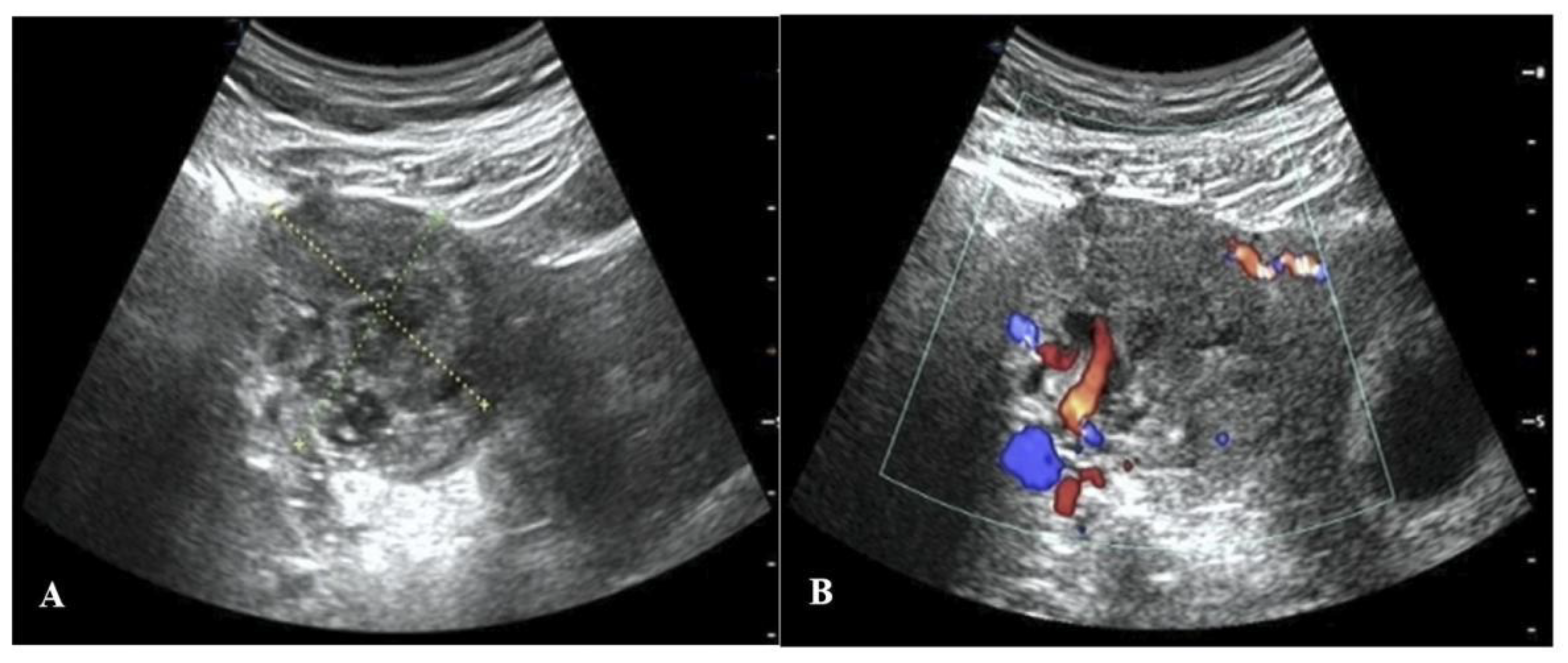 Jpm 13 00332 g002 Jpm 13 00332 g002