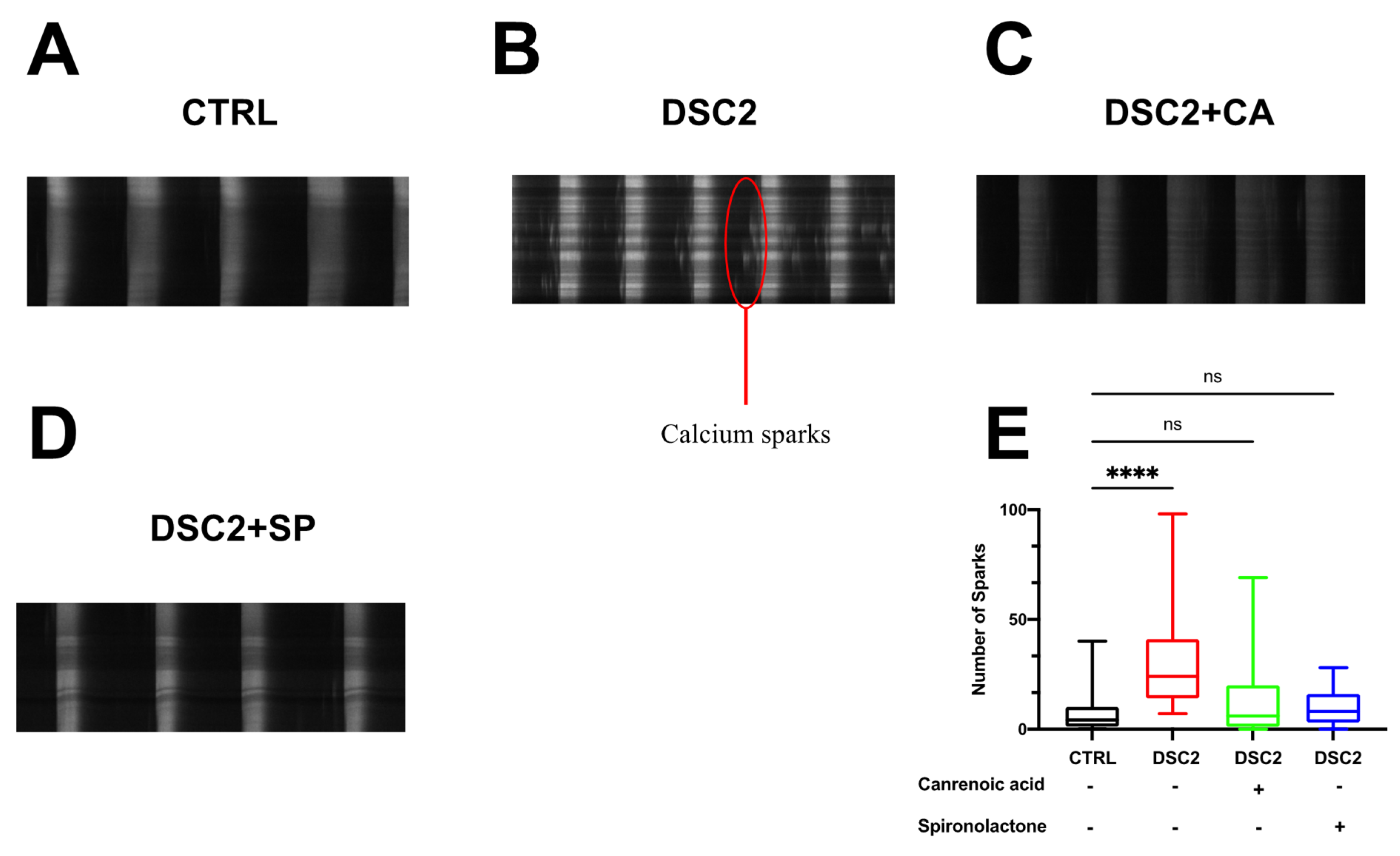 JPM Free Full-Text Spironolactone as a Potential New Treatment to