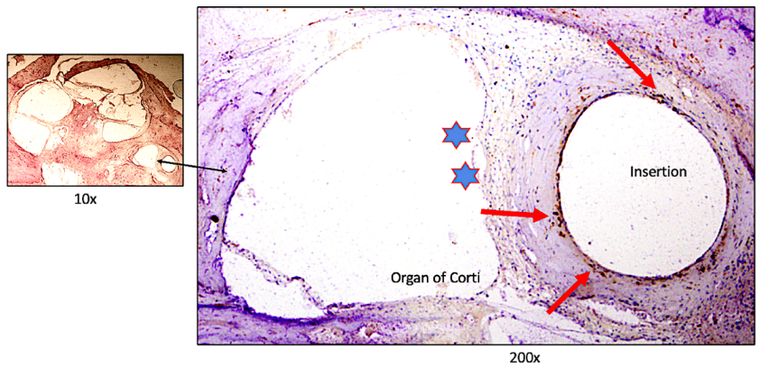 Jpm 13 00352 g004 Jpm 13 00352 g004