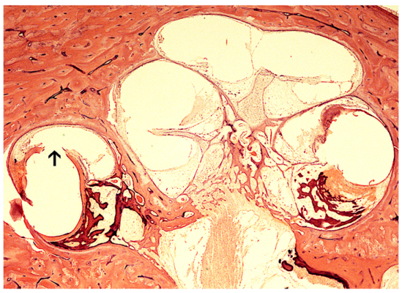 Jpm 13 00352 g005 Jpm 13 00352 g005