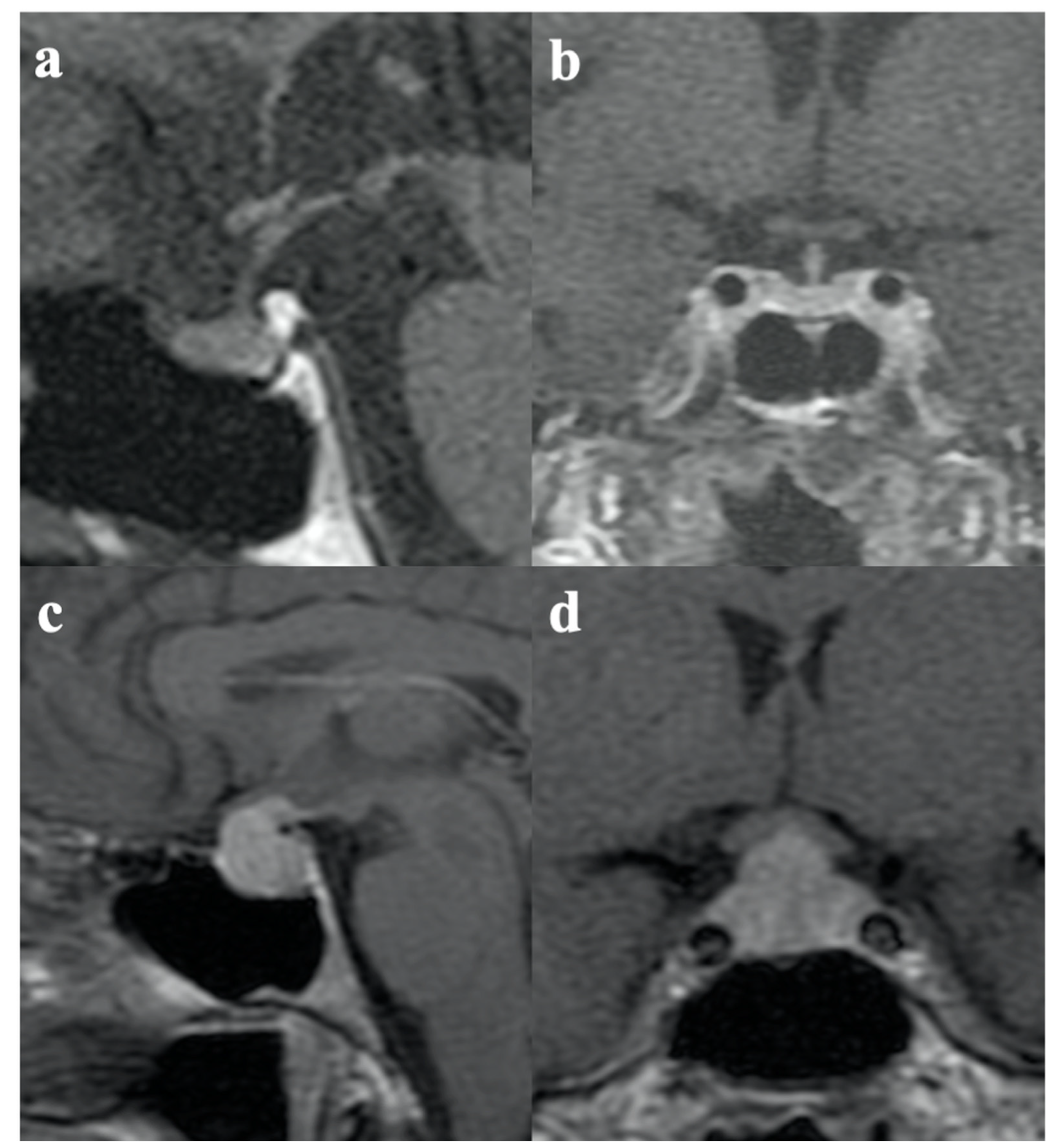 Jpm 13 00415 g001 Jpm 13 00415 g001