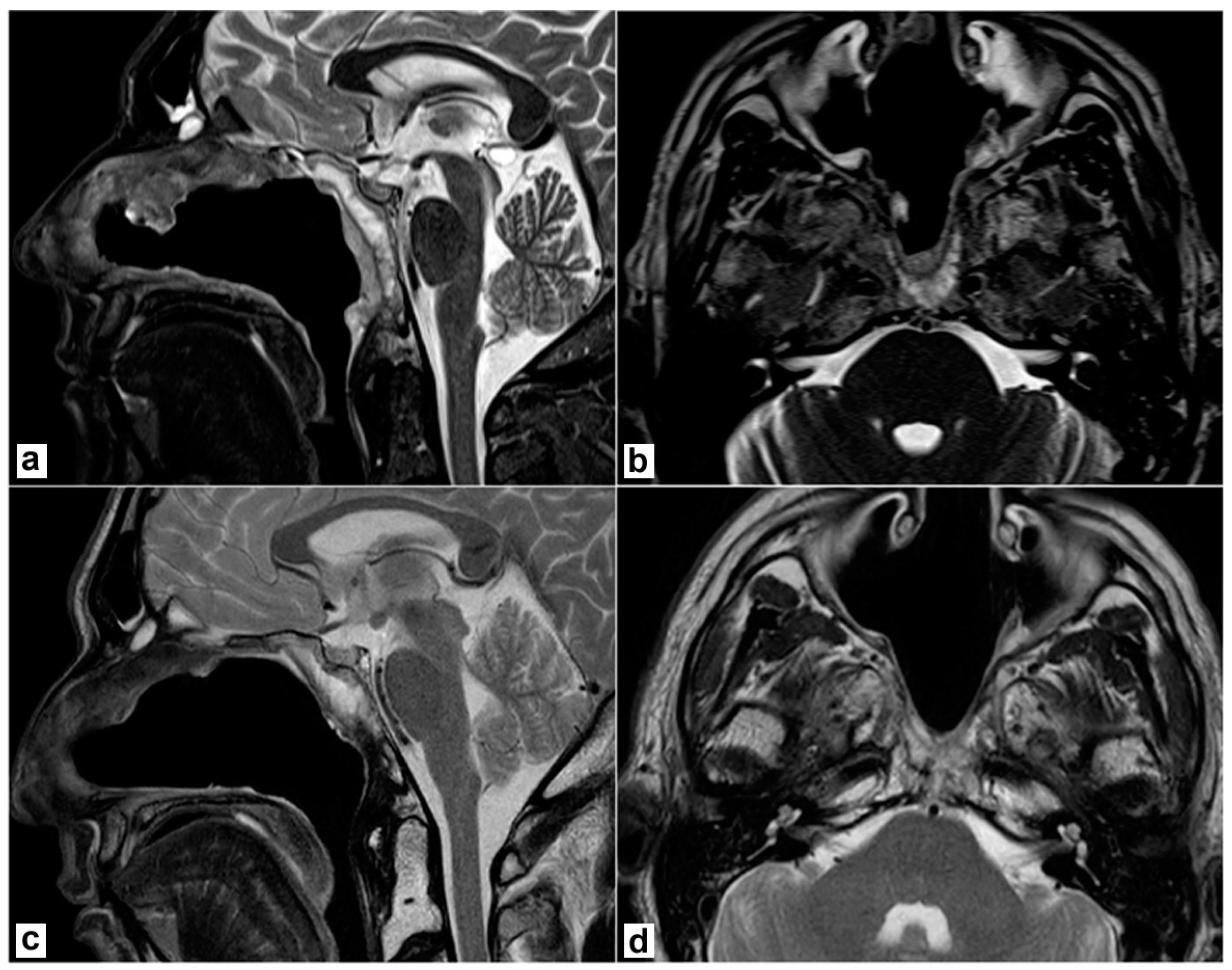 Jpm 13 00425 g002 Jpm 13 00425 g002