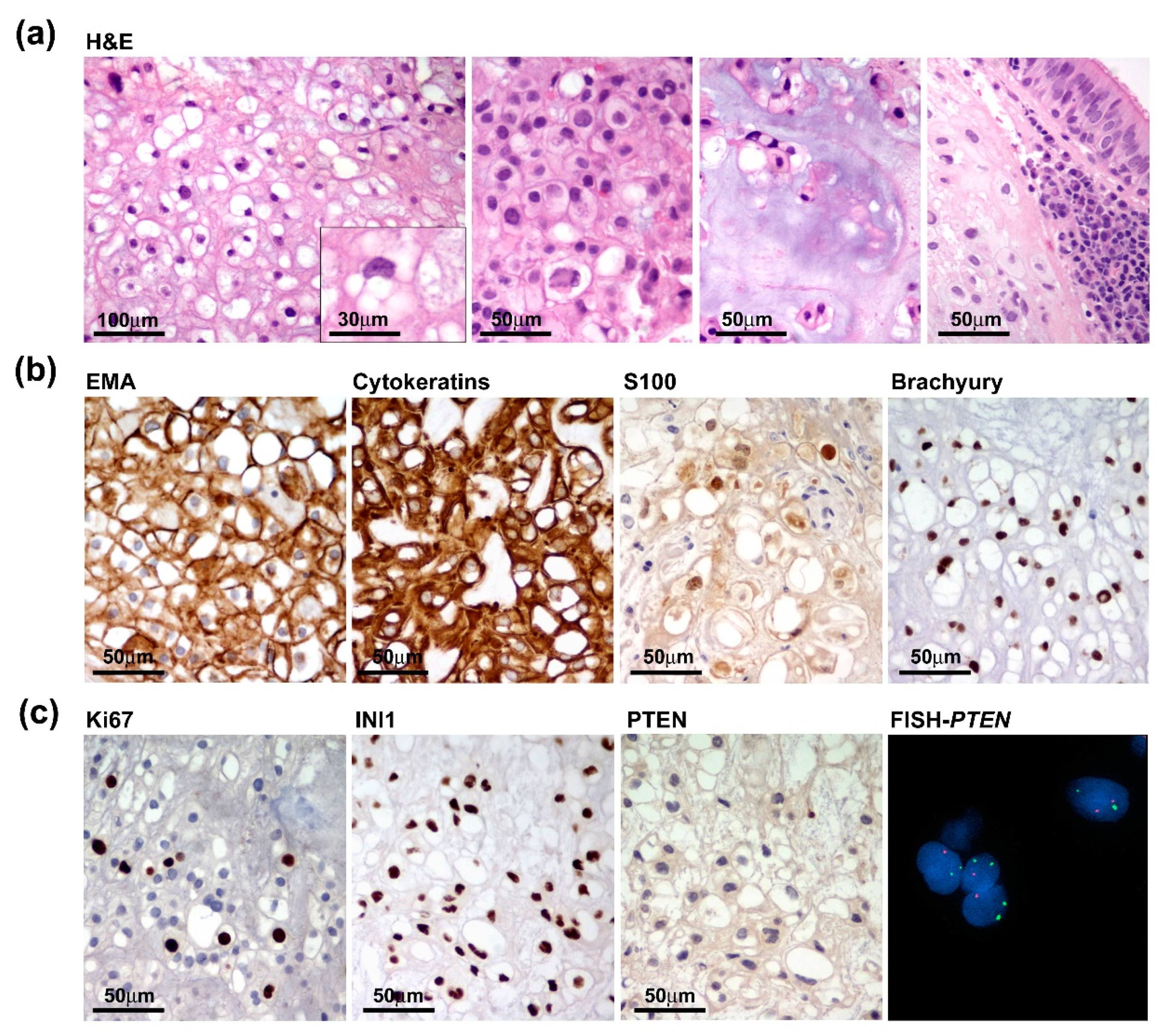Jpm 13 00425 g003 Jpm 13 00425 g003