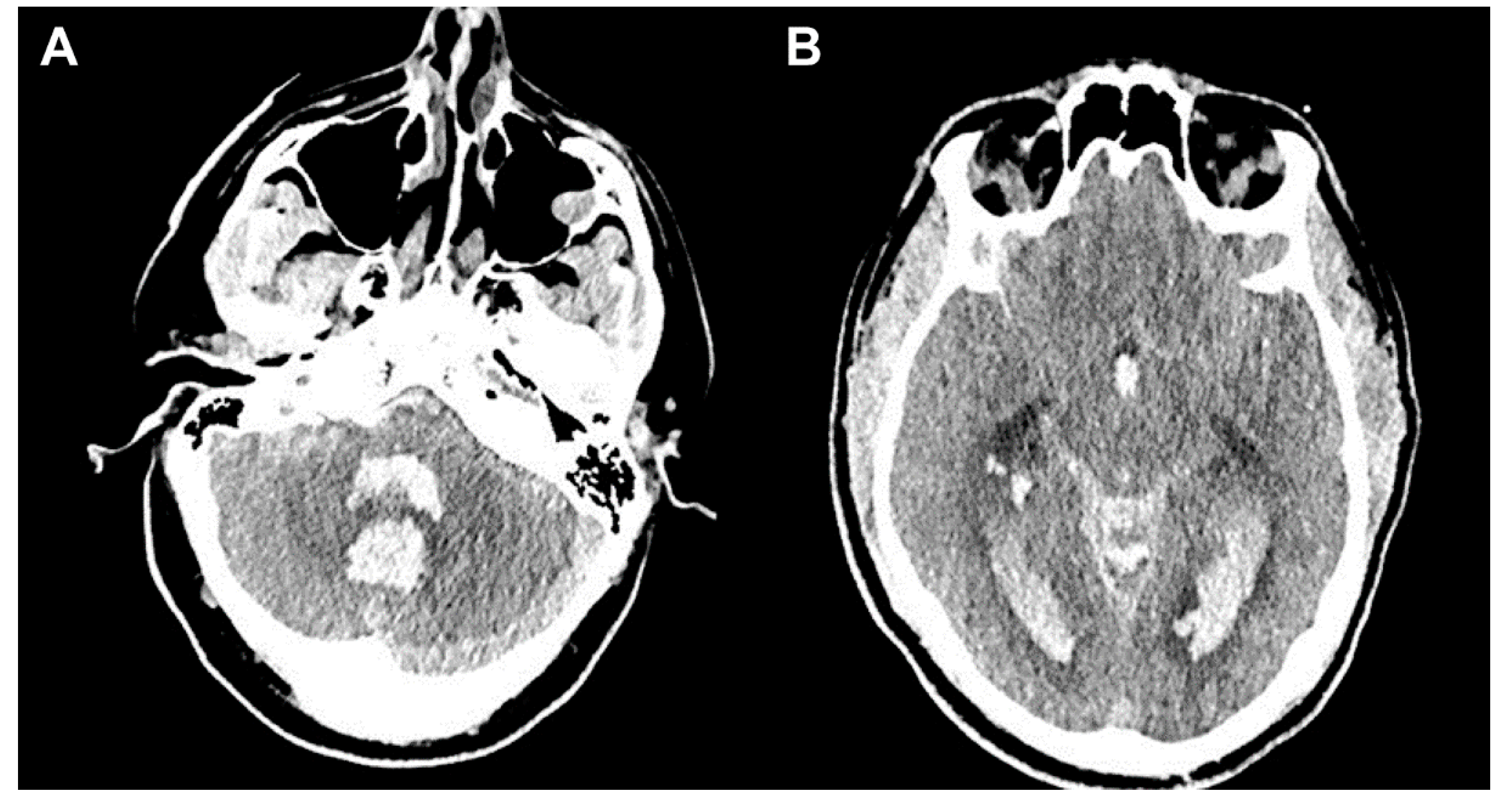 Jpm 13 00428 g003 Jpm 13 00428 g003