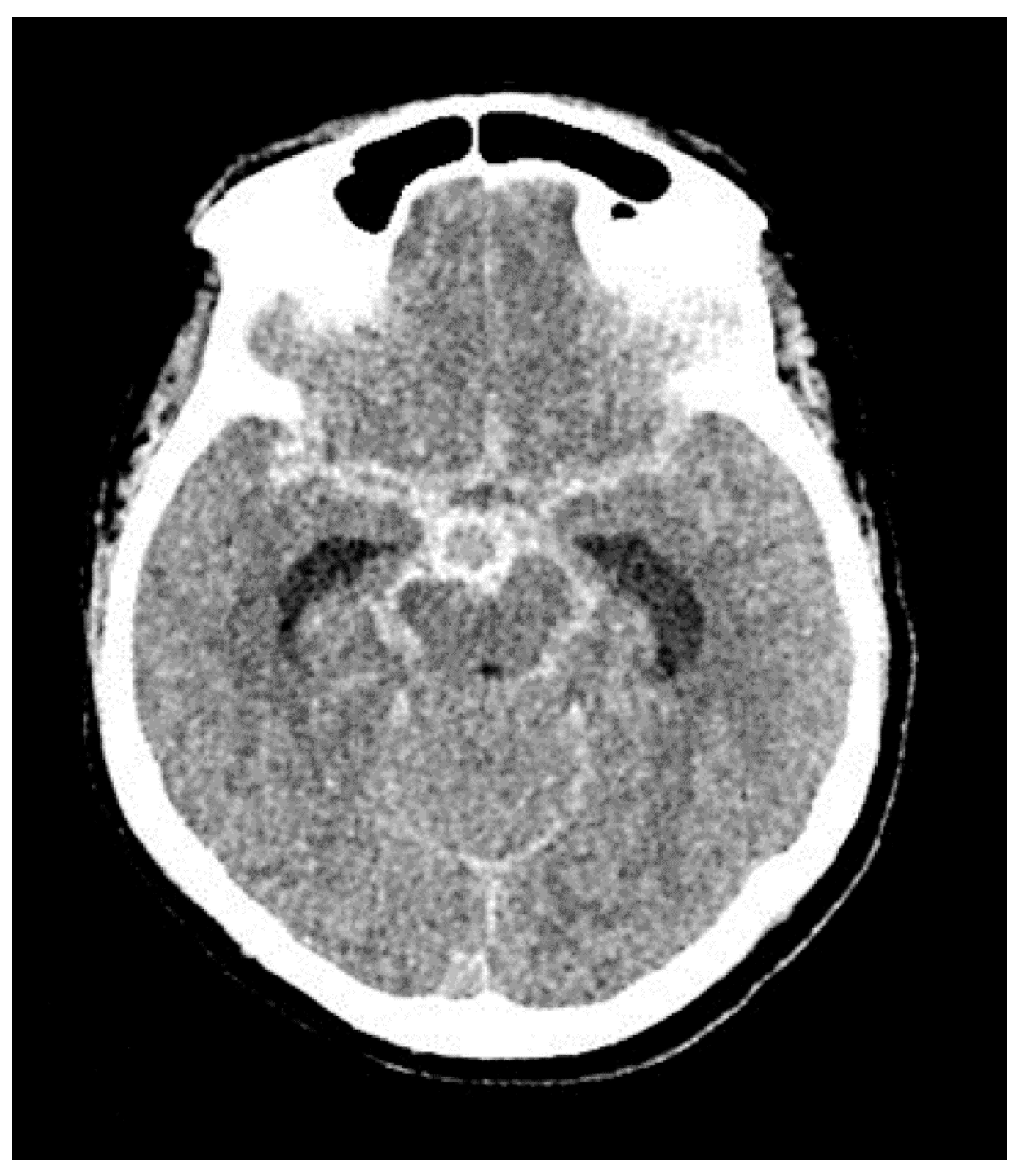 Jpm 13 00428 g004 Jpm 13 00428 g004